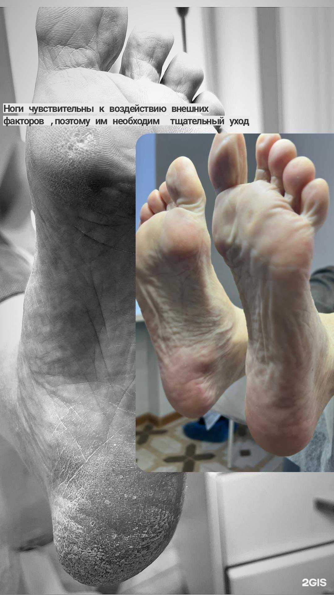 Отзывы на компанию Кабинет подолога в Волгограде c фото