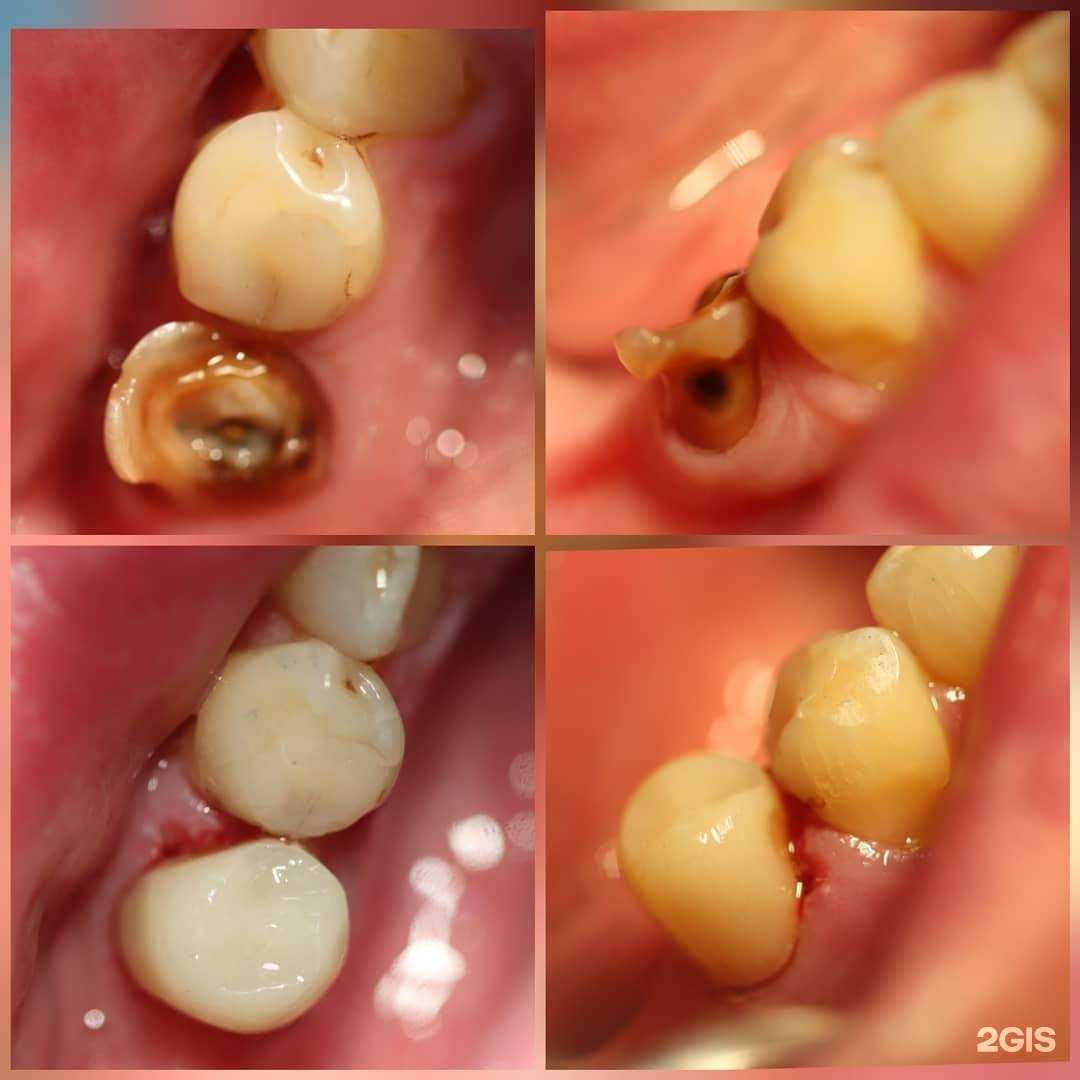Отзывы на компанию Дент акс в Екатеринбурге c фото
