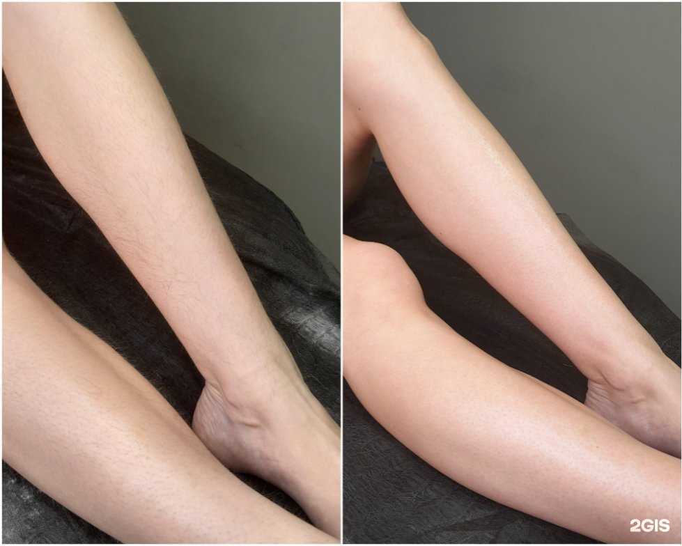 Отзывы на компанию Студия депиляции в г. Тюмень c фото