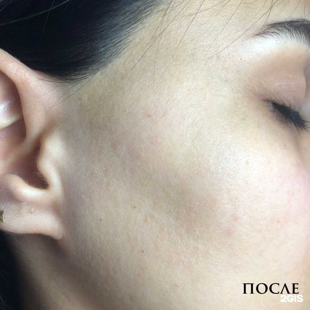 Отзывы на компанию LaRein в Сочи c фото