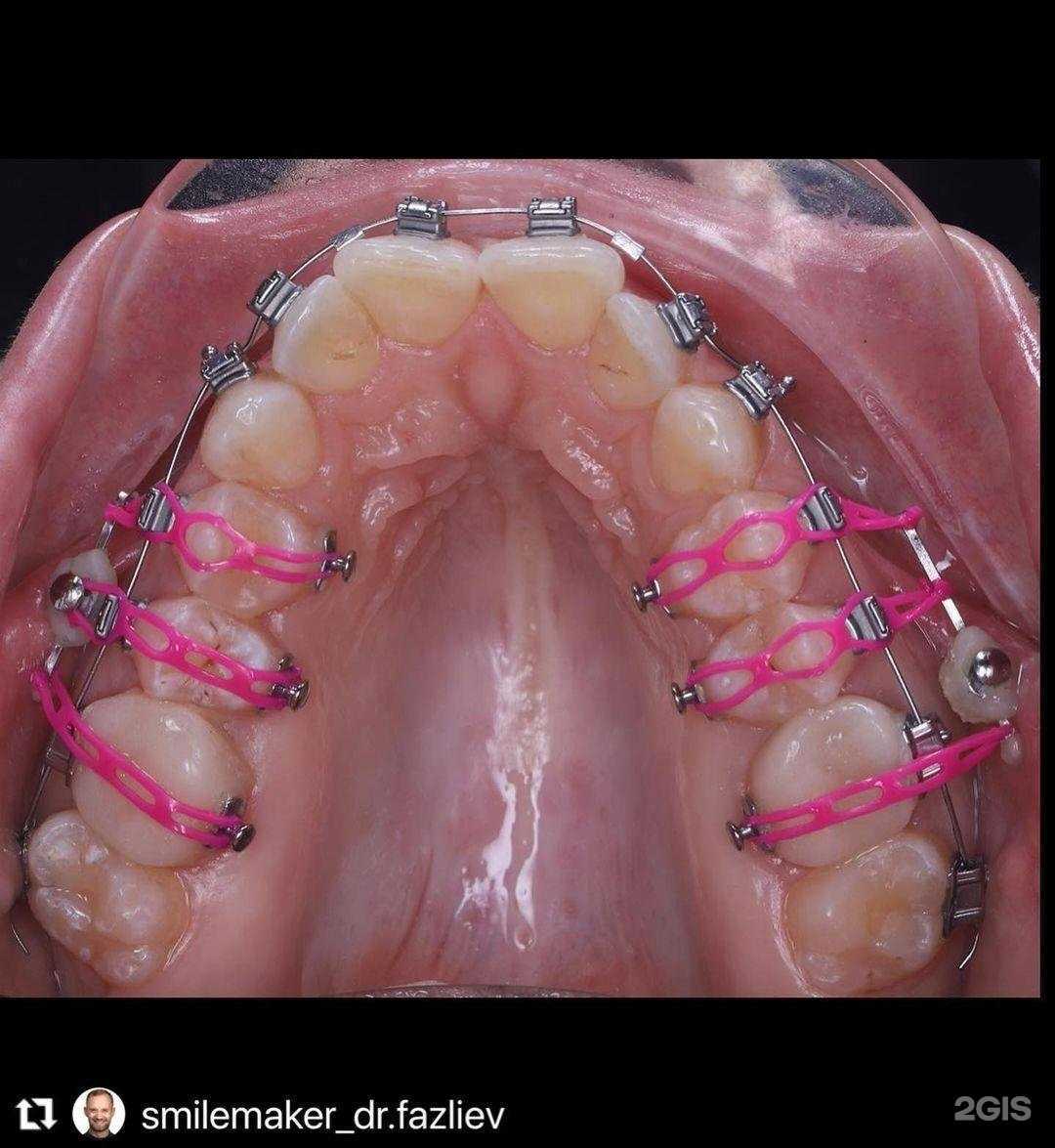 Отзывы на компанию ПроОрто в г. Казань c фото