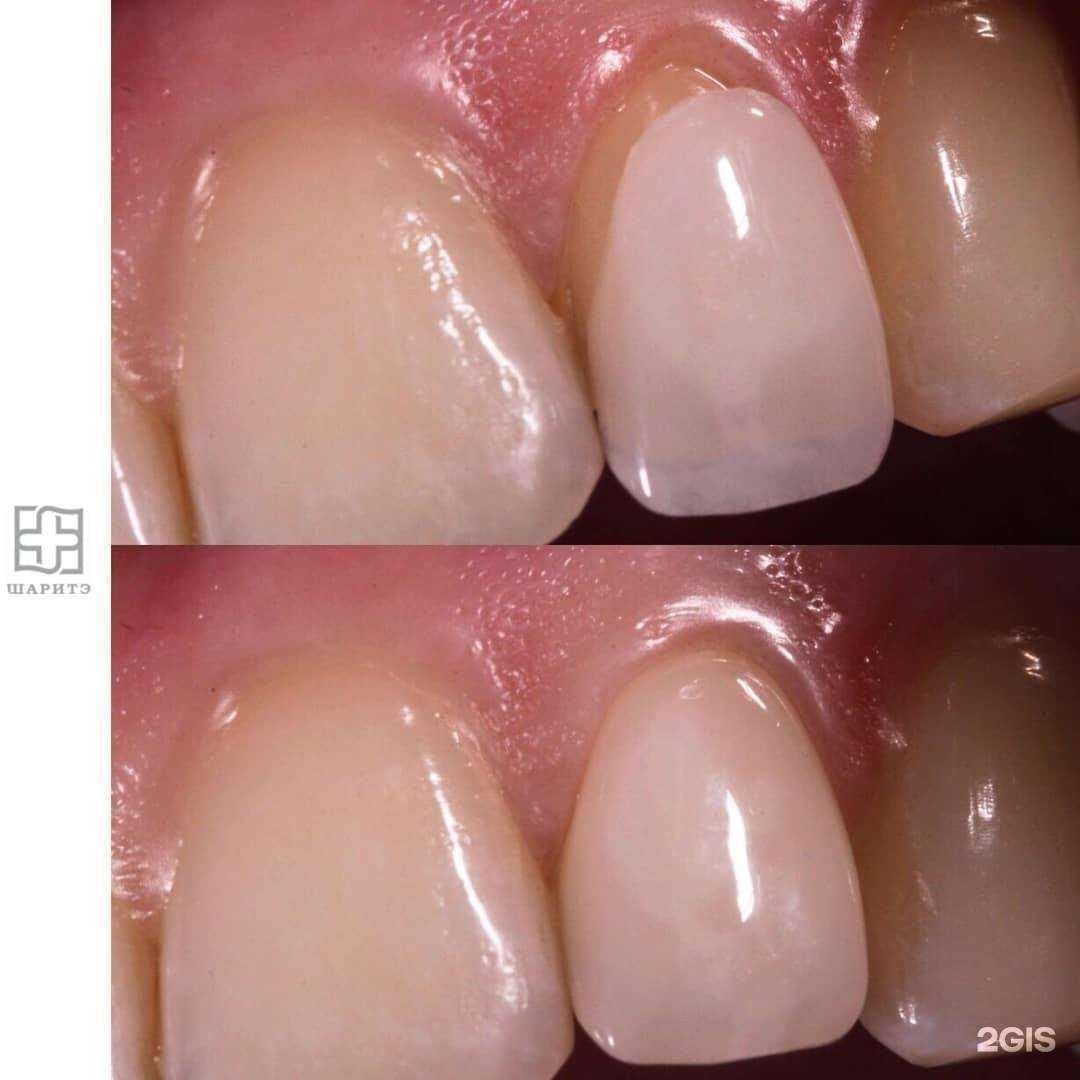 Отзывы на компанию Шаритэ в Краснодаре c фото