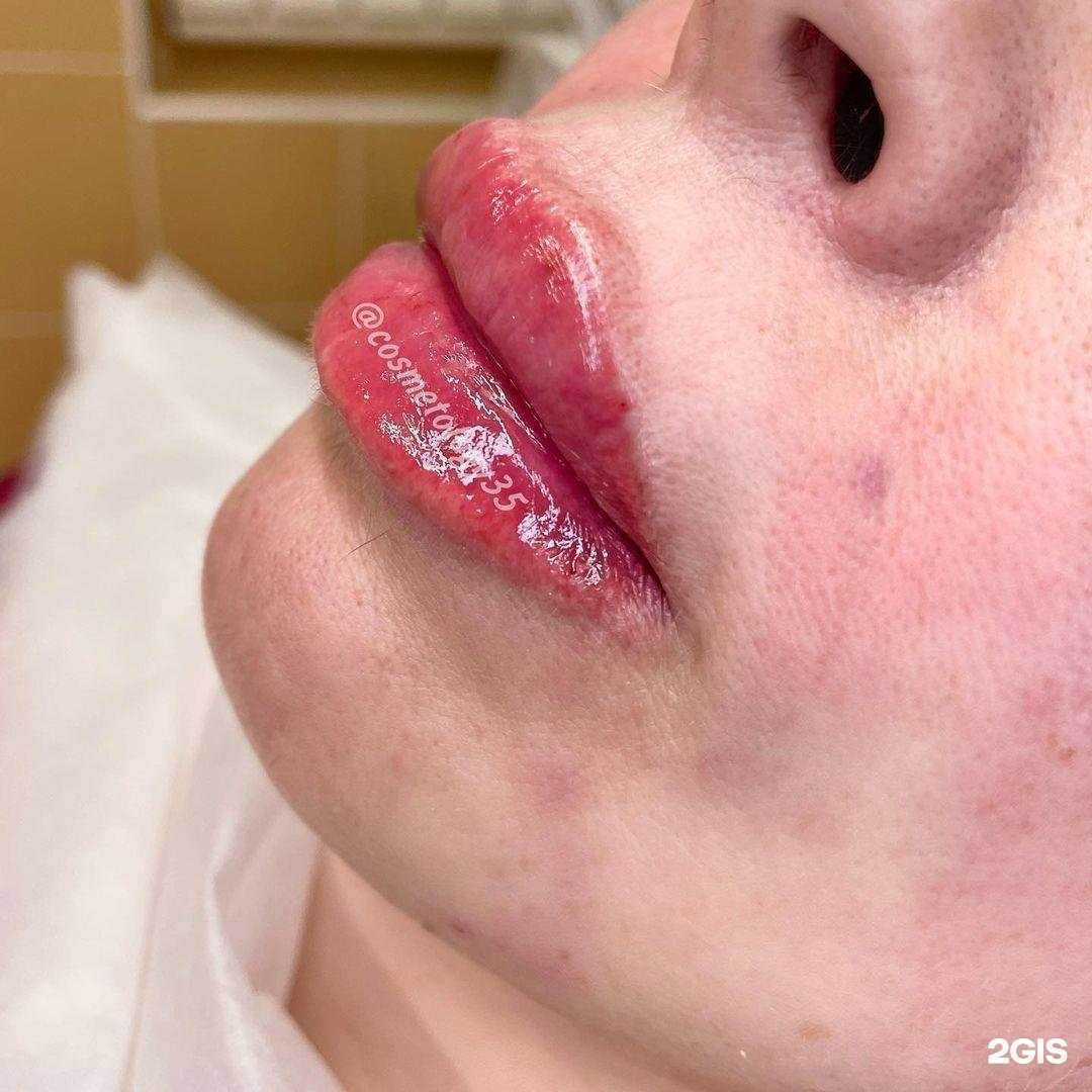 Отзывы на компанию Cosmetology35 в Вологде c фото