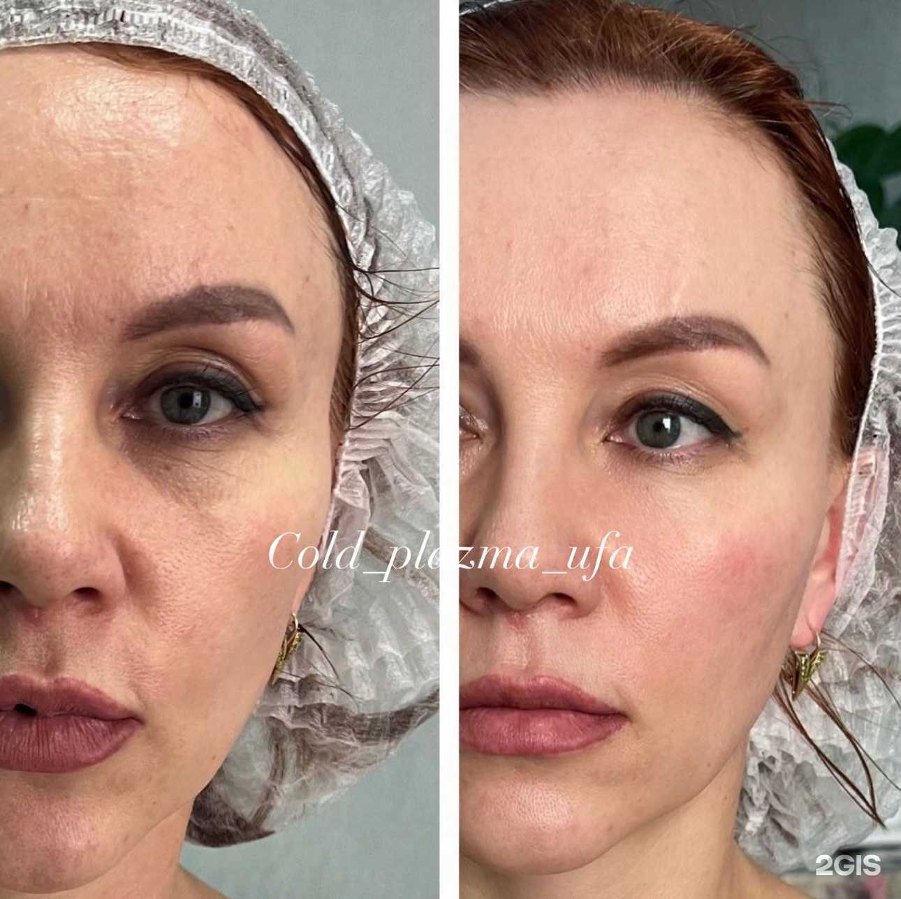 Отзывы на компанию Cold Plazma в Уфе c фото