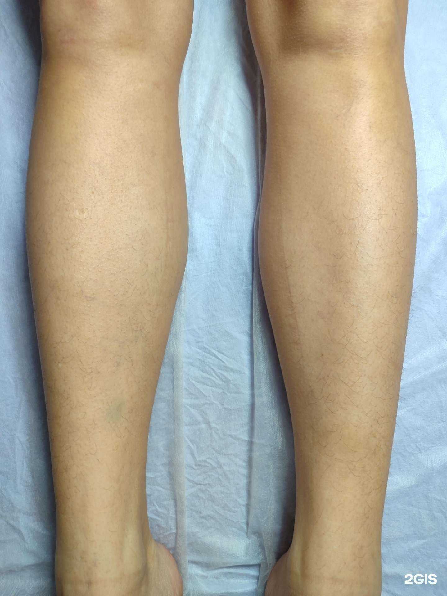 Отзывы на компанию Smooth Skin в Искитиме c фото