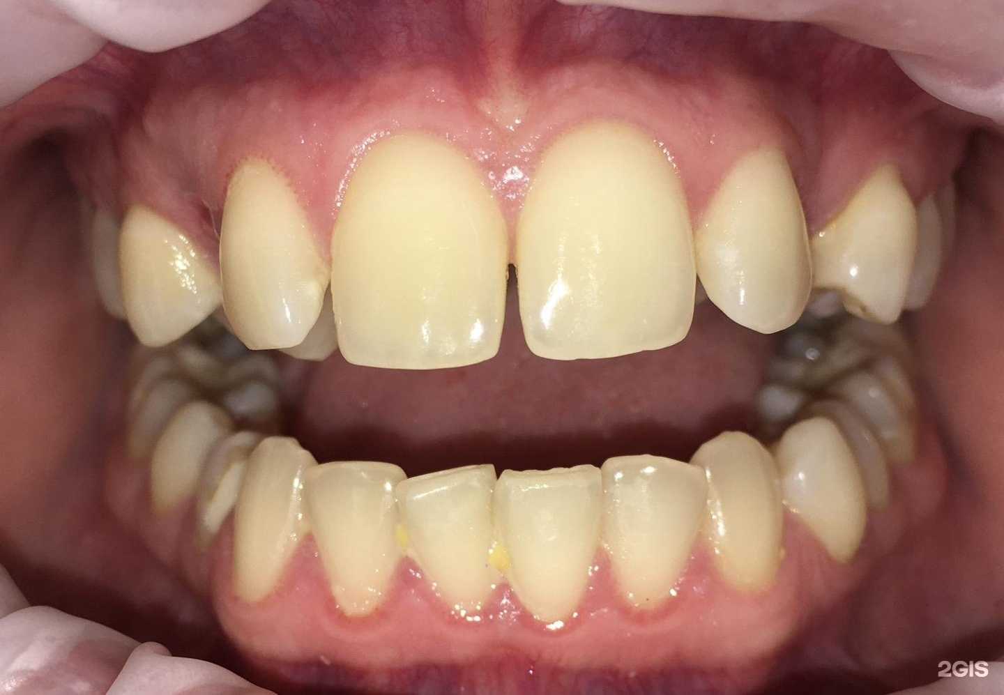 Отзывы на компанию Метелица в г. Ижевск c фото