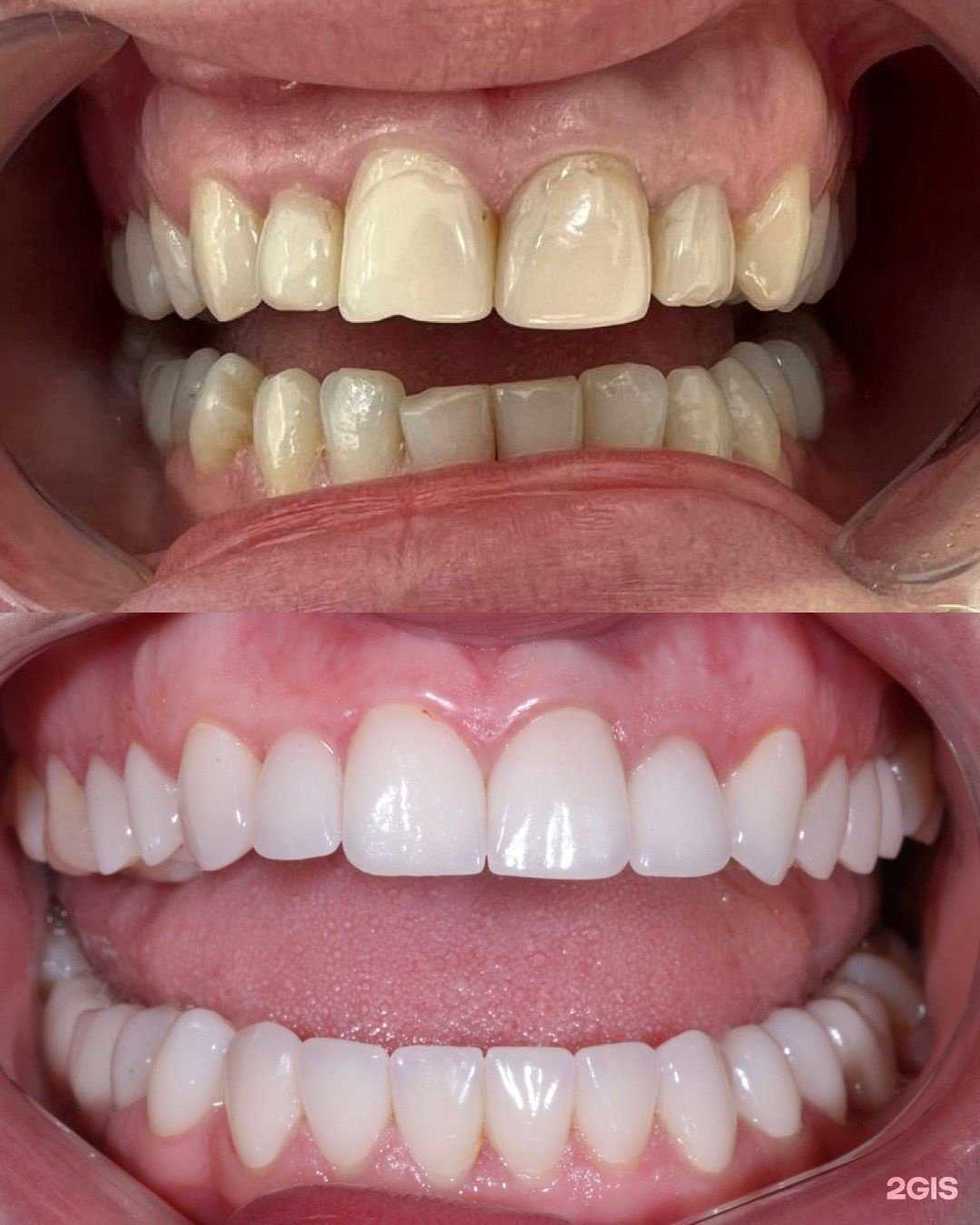 Отзывы на компанию Севак Стоматология в Махачкале c фото