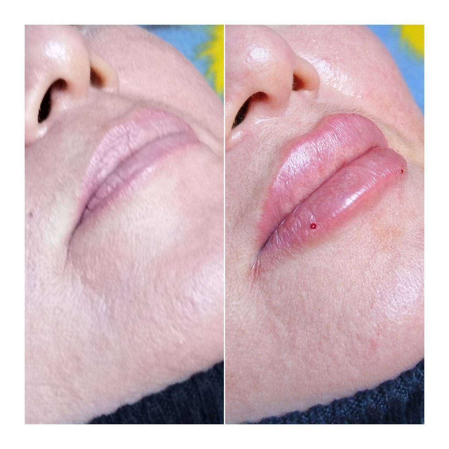 Отзывы на компанию Кабинет косметологии в Астрахани c фото