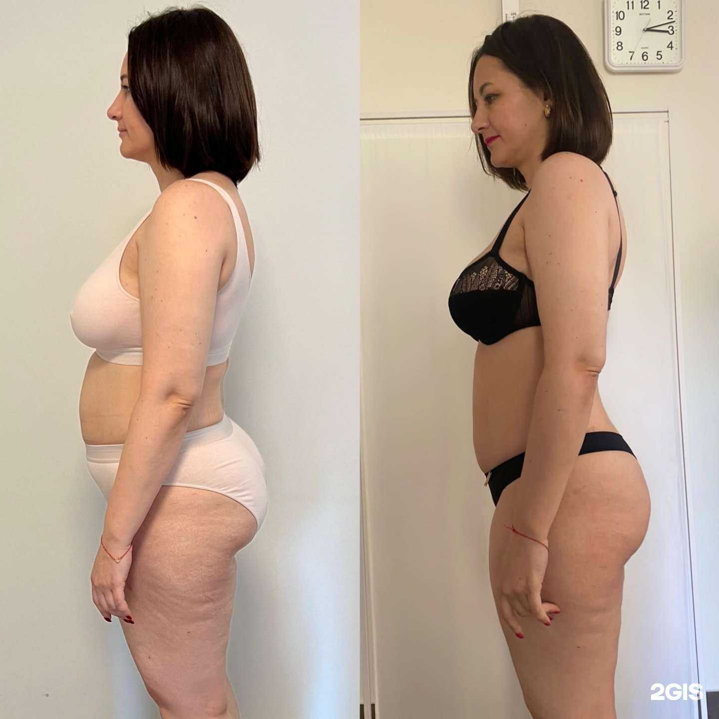 Отзывы на компанию Refresh clinic в Казани c фото