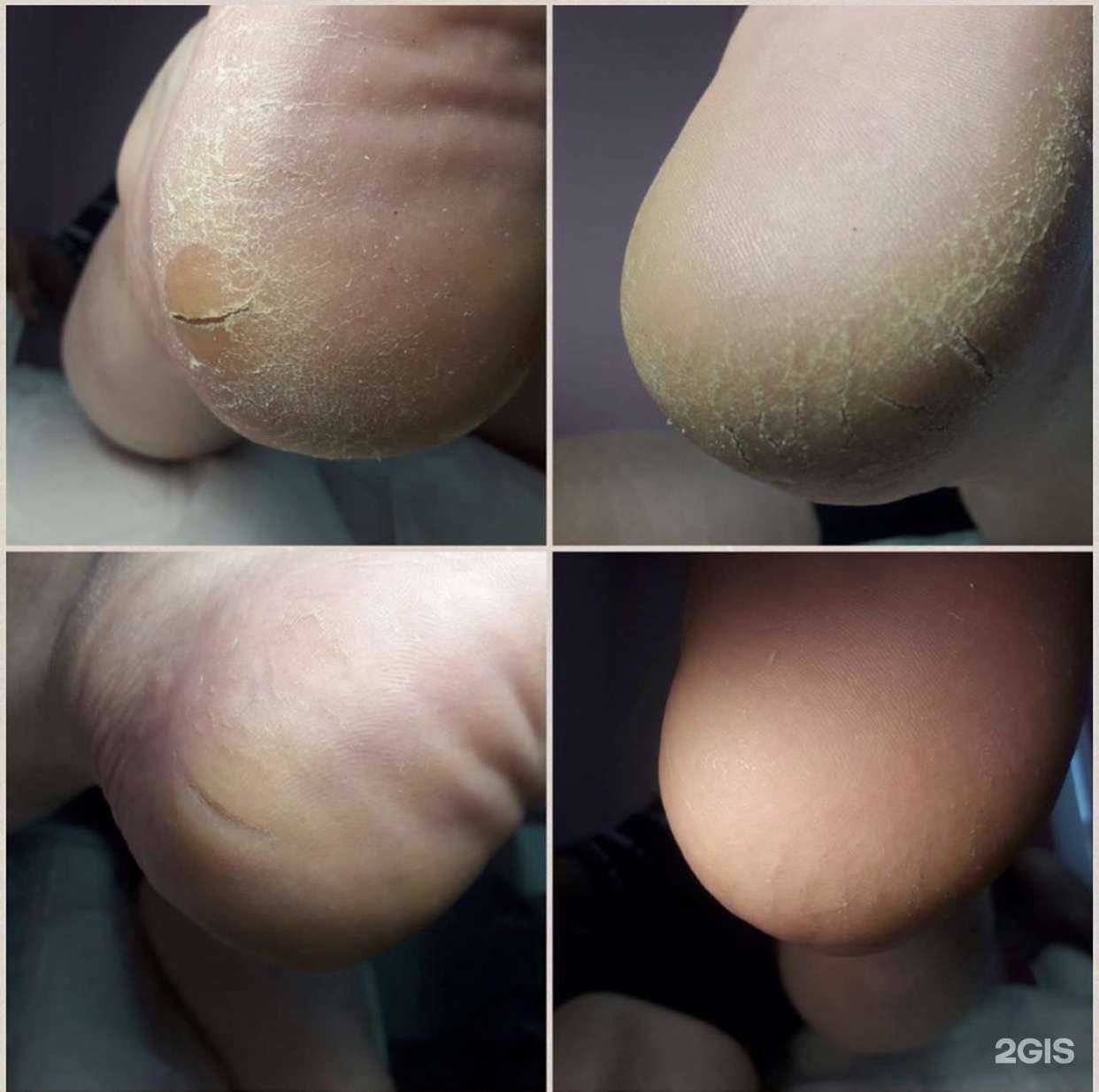 Отзывы на компанию Prof. Nails в Черногорске c фото