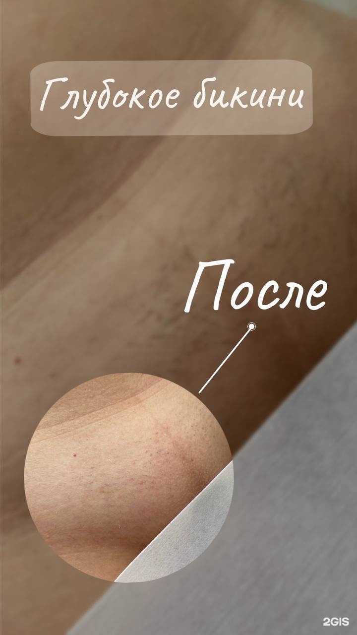 Отзывы на компанию Кабинет депиляции в г. Новороссийск c фото
