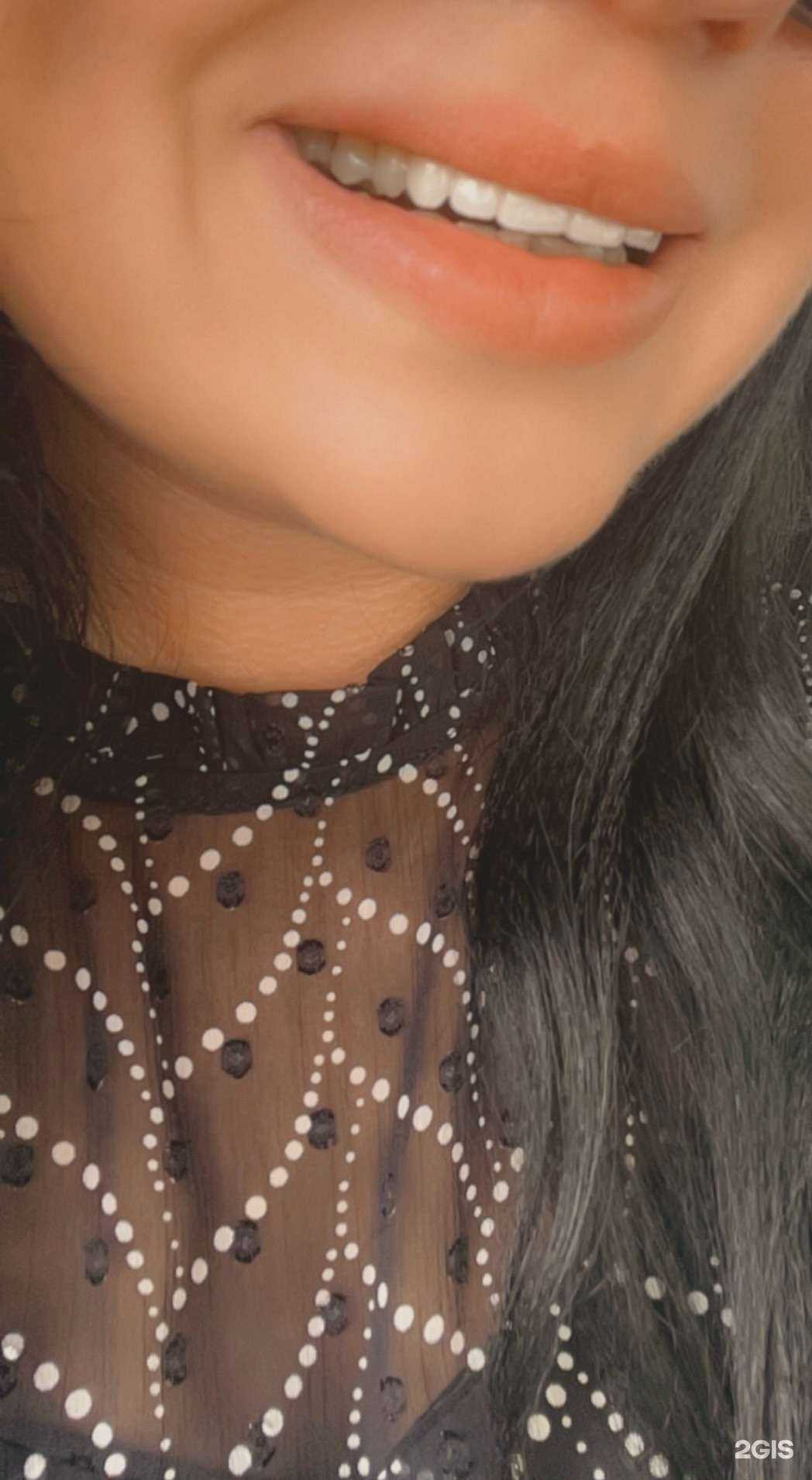 Отзывы на компанию Дентал-сервис в г. Абакан c фото