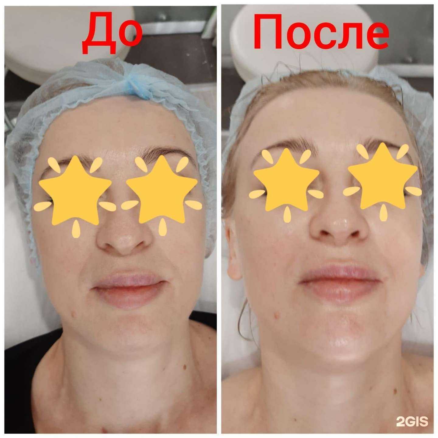 Отзывы на компанию Star Kosmetology в Ростове-на-Дону c фото