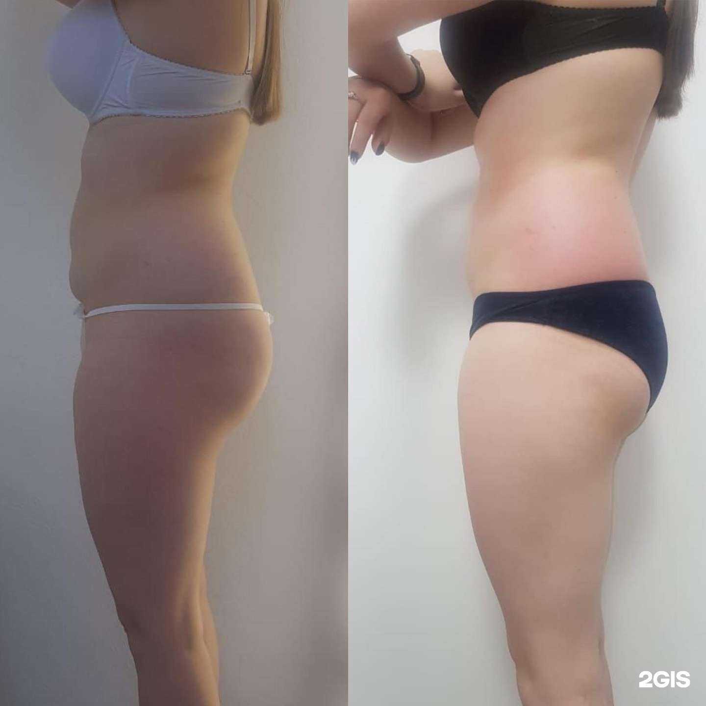 Отзывы на компанию Laser Family в г. Ярославль c фото