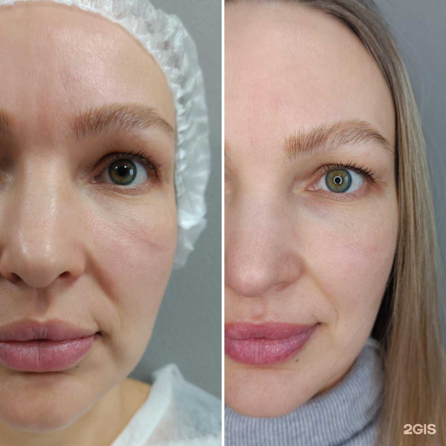 Отзывы на компанию Vasileva_procosmo в Хабаровске c фото