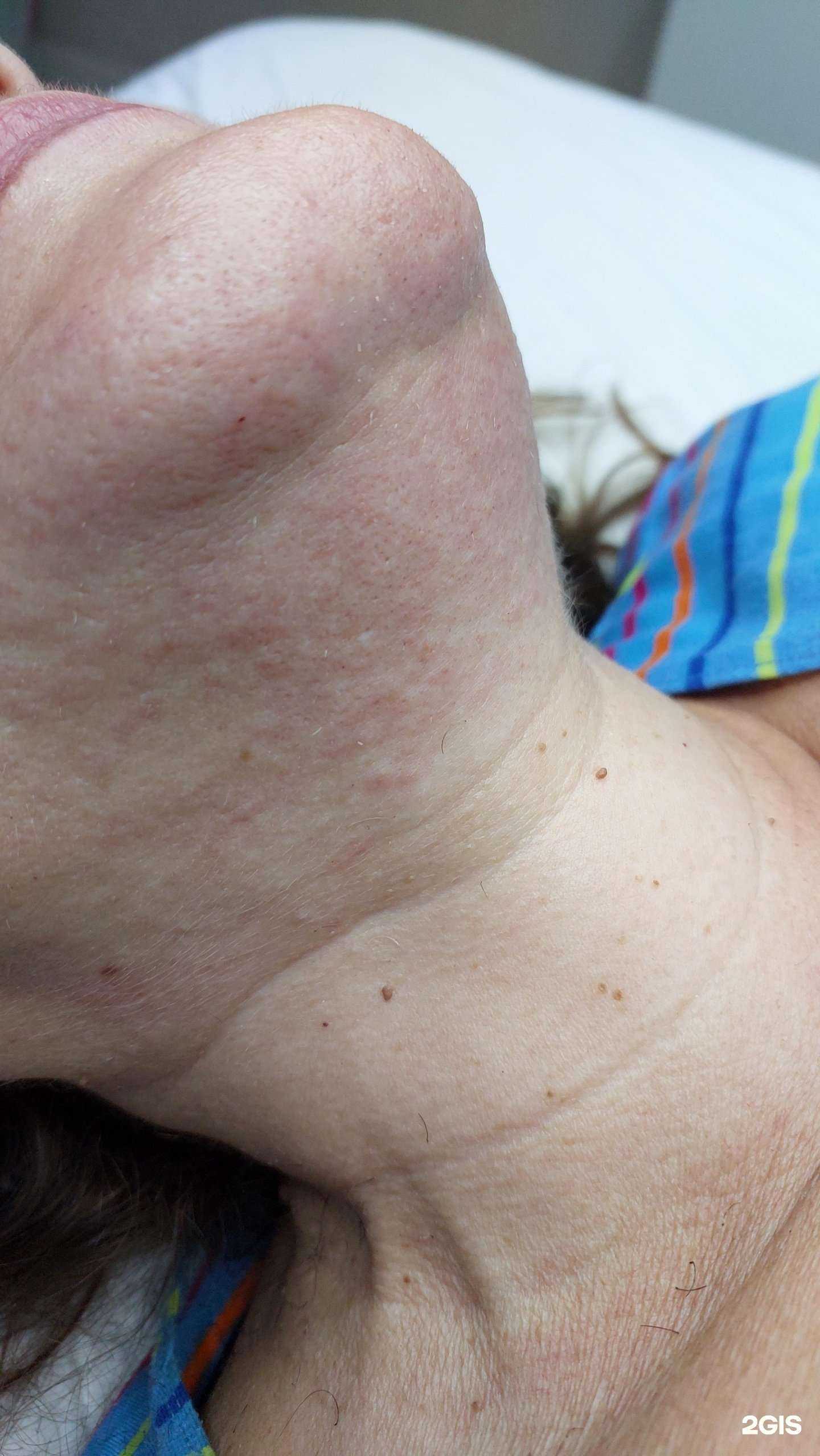 Отзывы на компанию Студия электроэпиляции в Краснодаре c фото