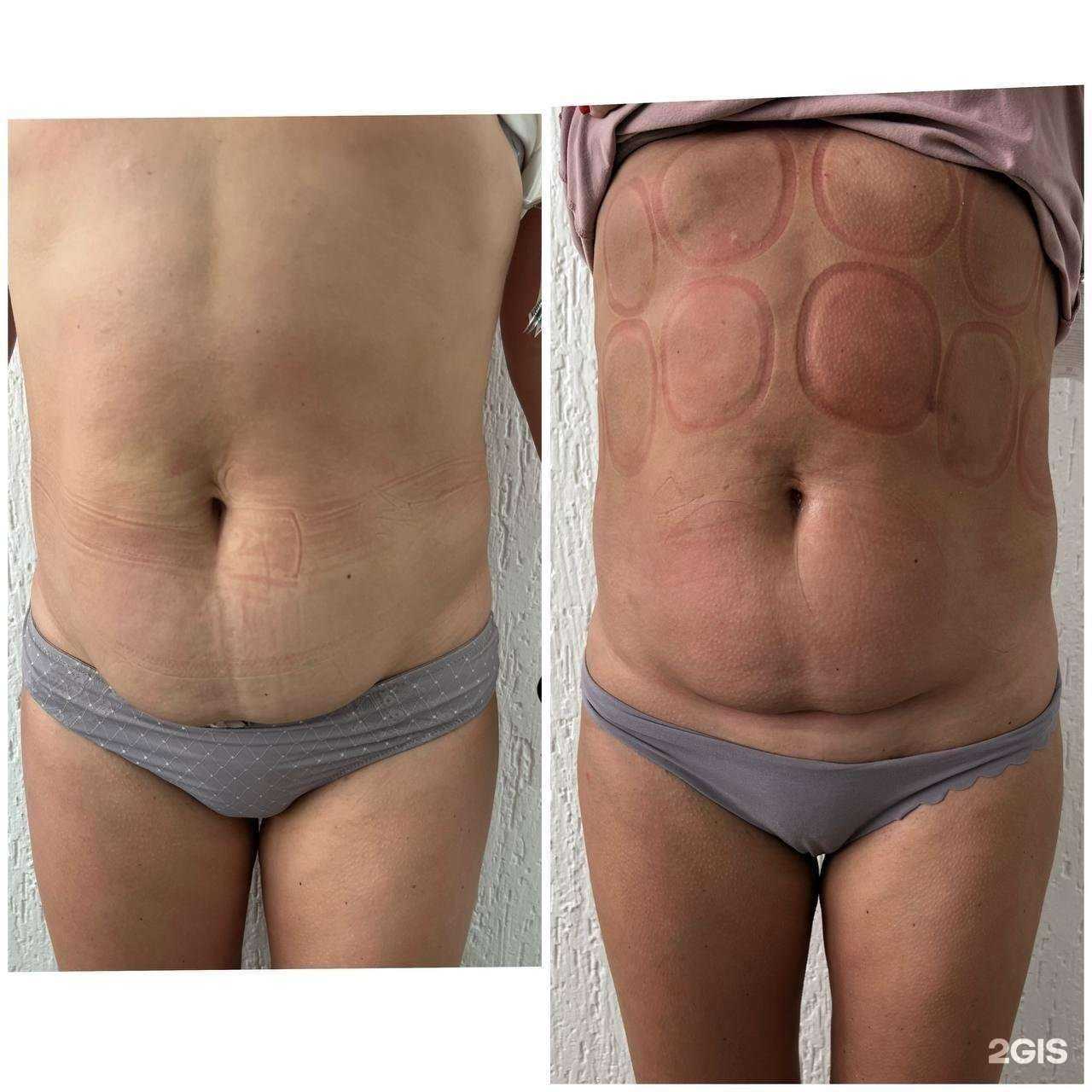 Отзывы на компанию Антицеллюлитная в Краснодаре c фото