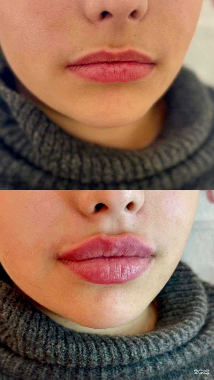 Отзывы на компанию Криомед в Воронеже c фото