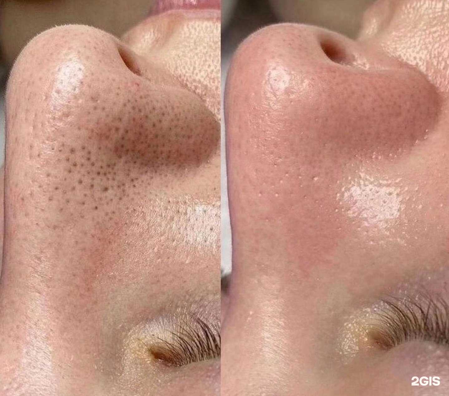 Отзывы на компанию Кабинет косметолога в г. Тольятти c фото