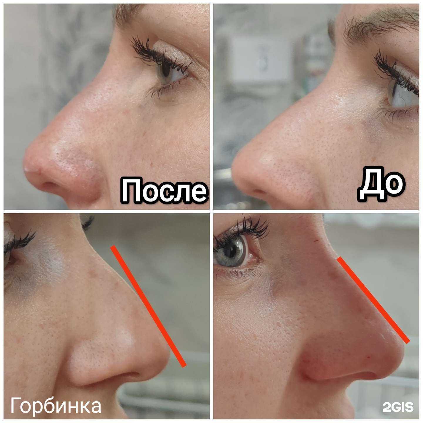 Отзывы на компанию Фламинго в Нижнем Новгороде c фото