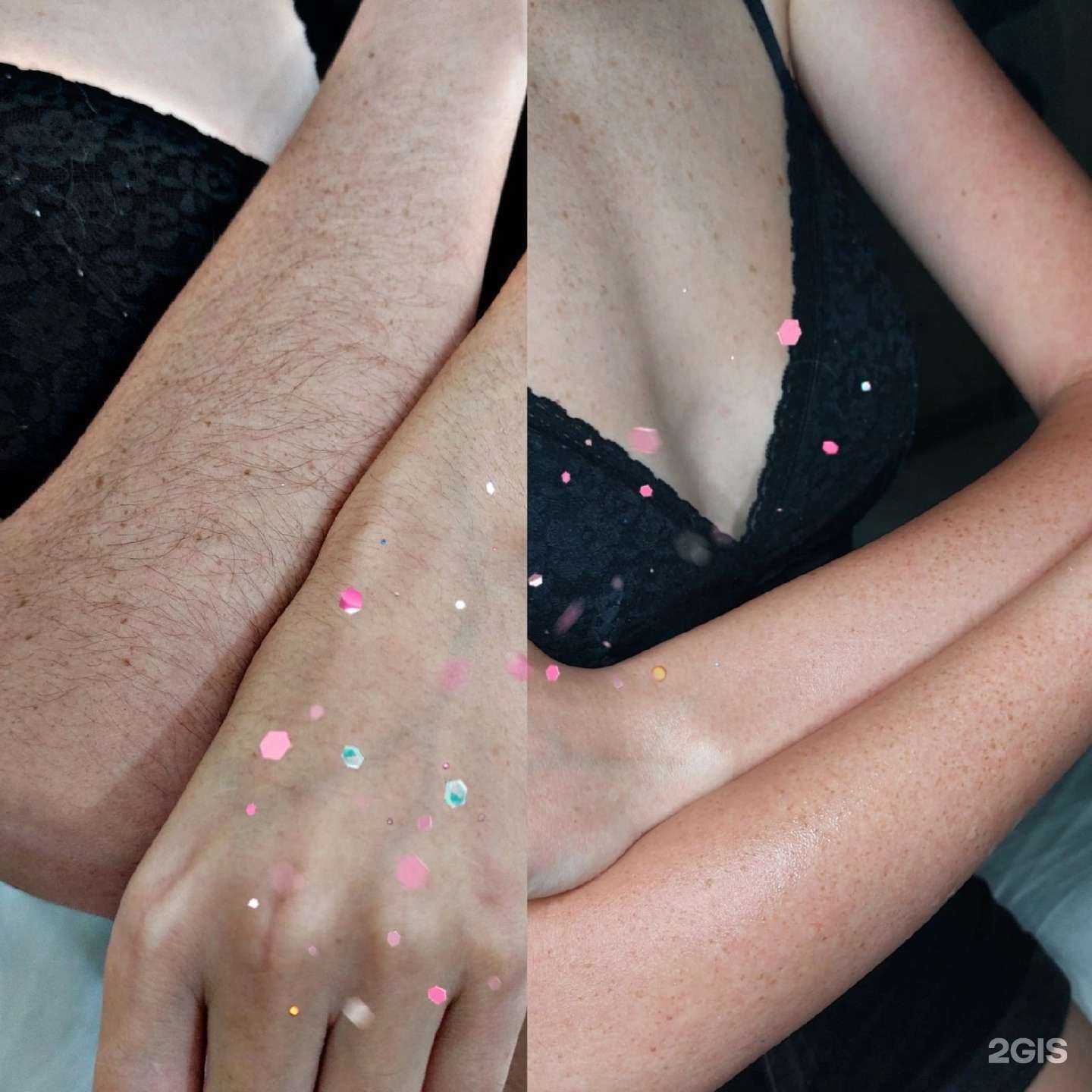 Отзывы на компанию Кабинет эпиляции в г. Омск c фото