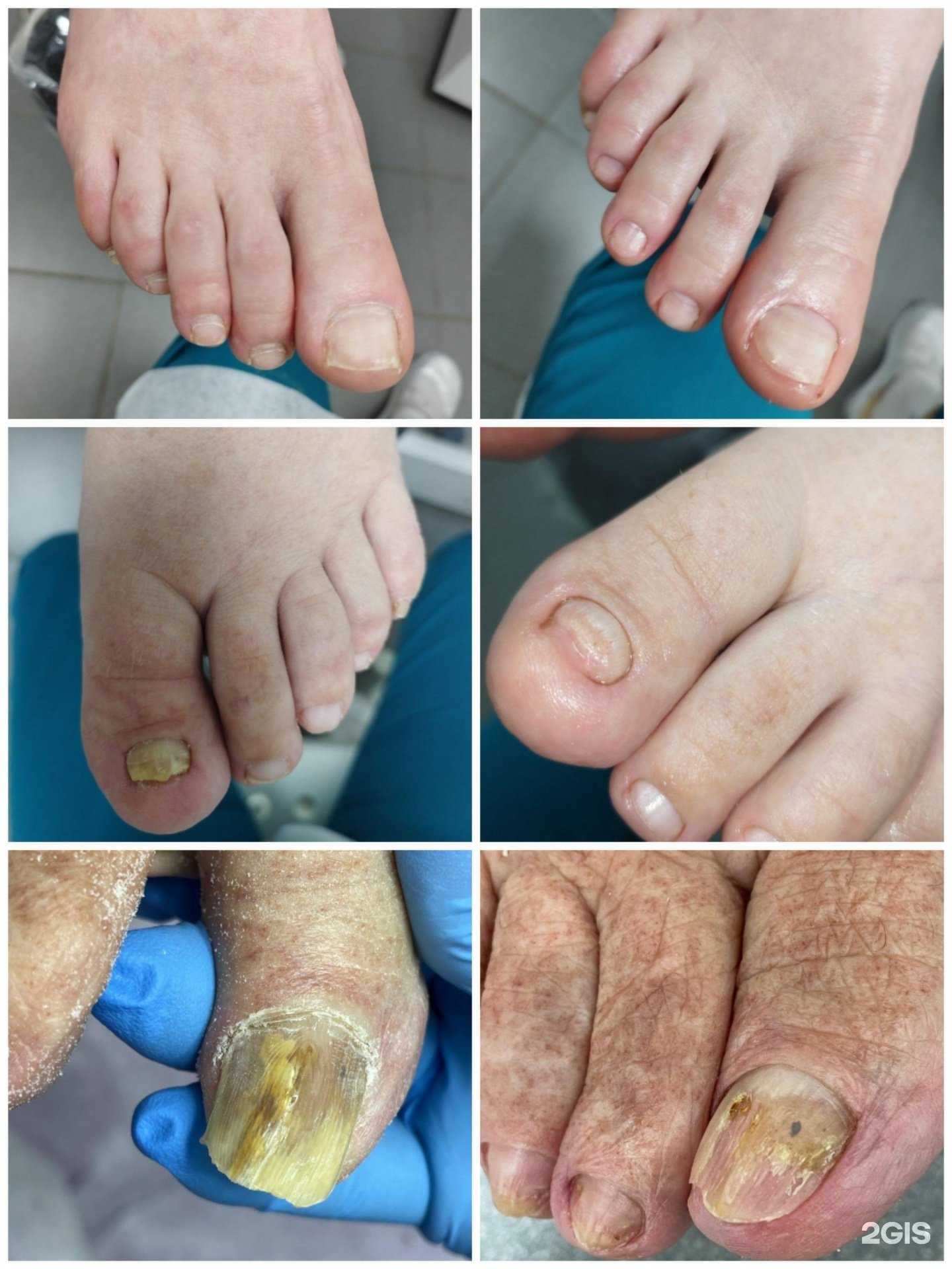 Отзывы на компанию Кабинет подолога в Томске c фото