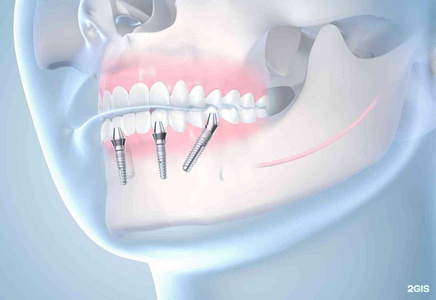 Отзывы на компанию Дорофеева Дент клиник в Краснодаре c фото