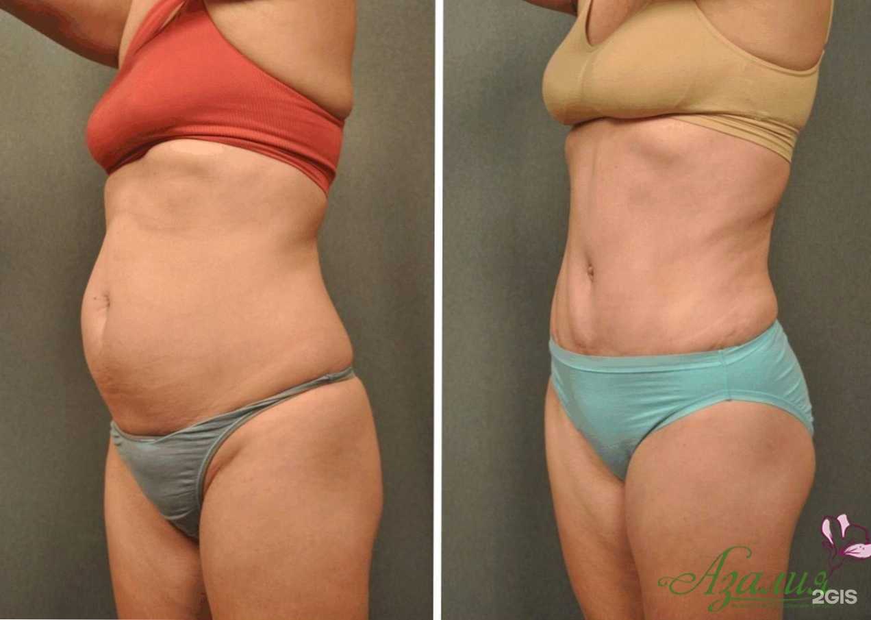 Отзывы на компанию Азалия в Новосибирске c фото