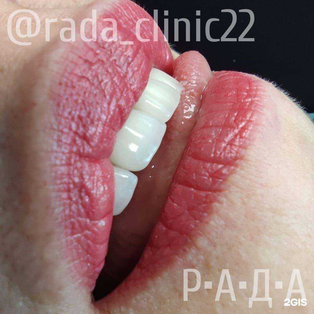 Отзывы на компанию РАДА в г. Барнаул c фото