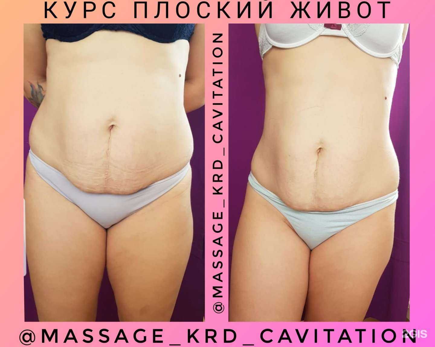 Отзывы на компанию Body shaping в г. Краснодар c фото
