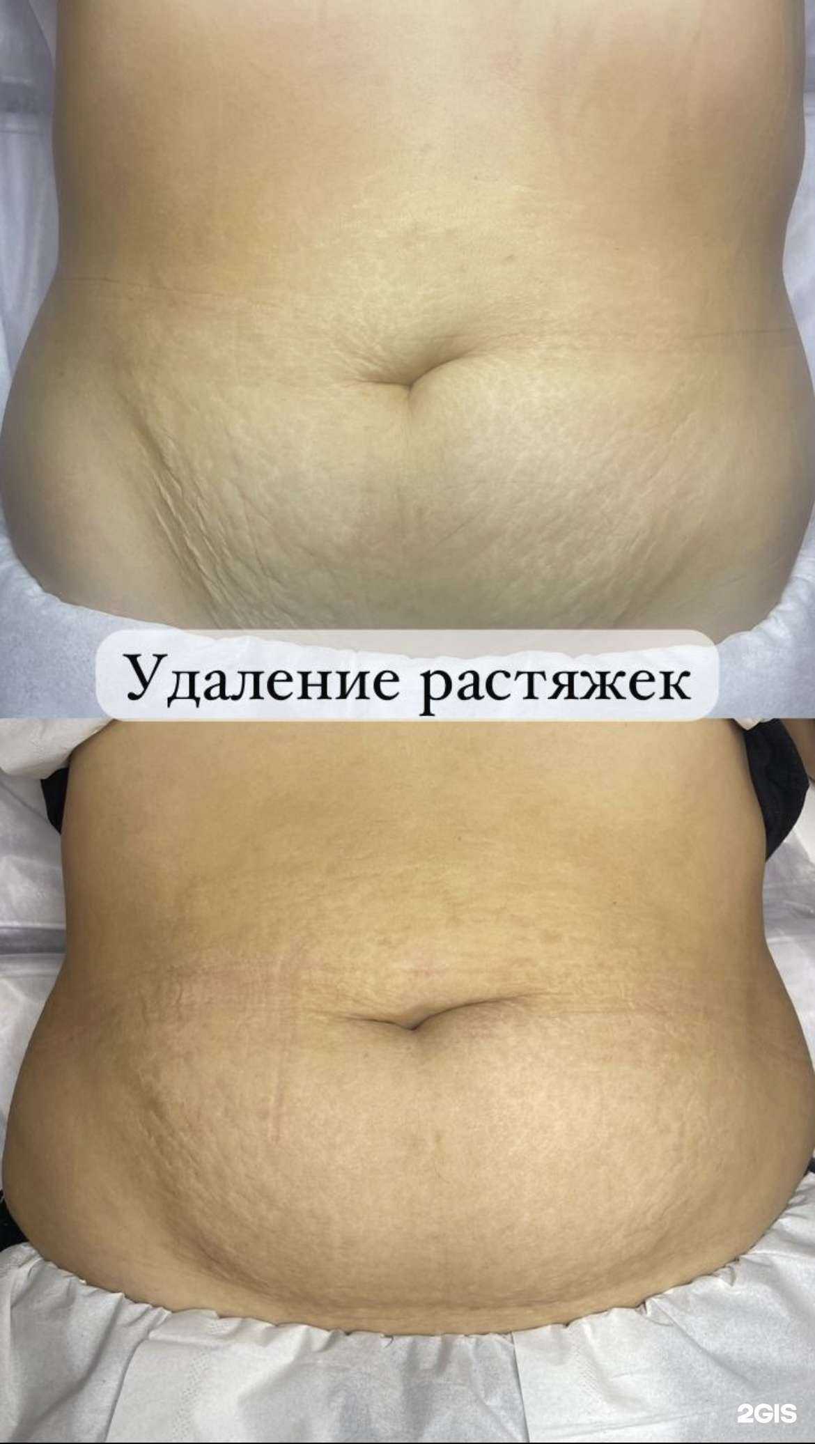 Отзывы на компанию Студия аппаратной косметологии в г. Краснодар c фото