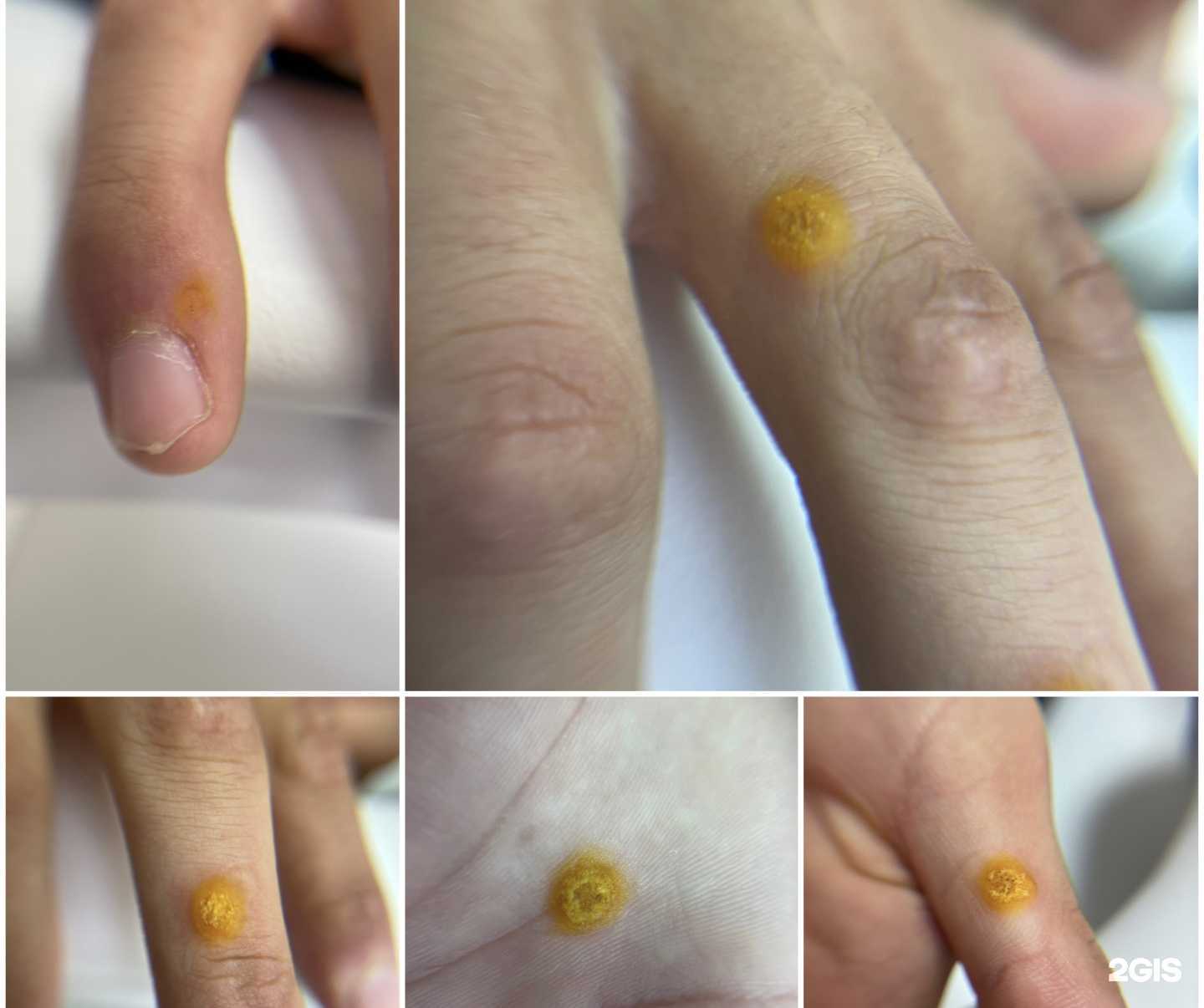 Отзывы на компанию Подологические решения  в Казани c фото