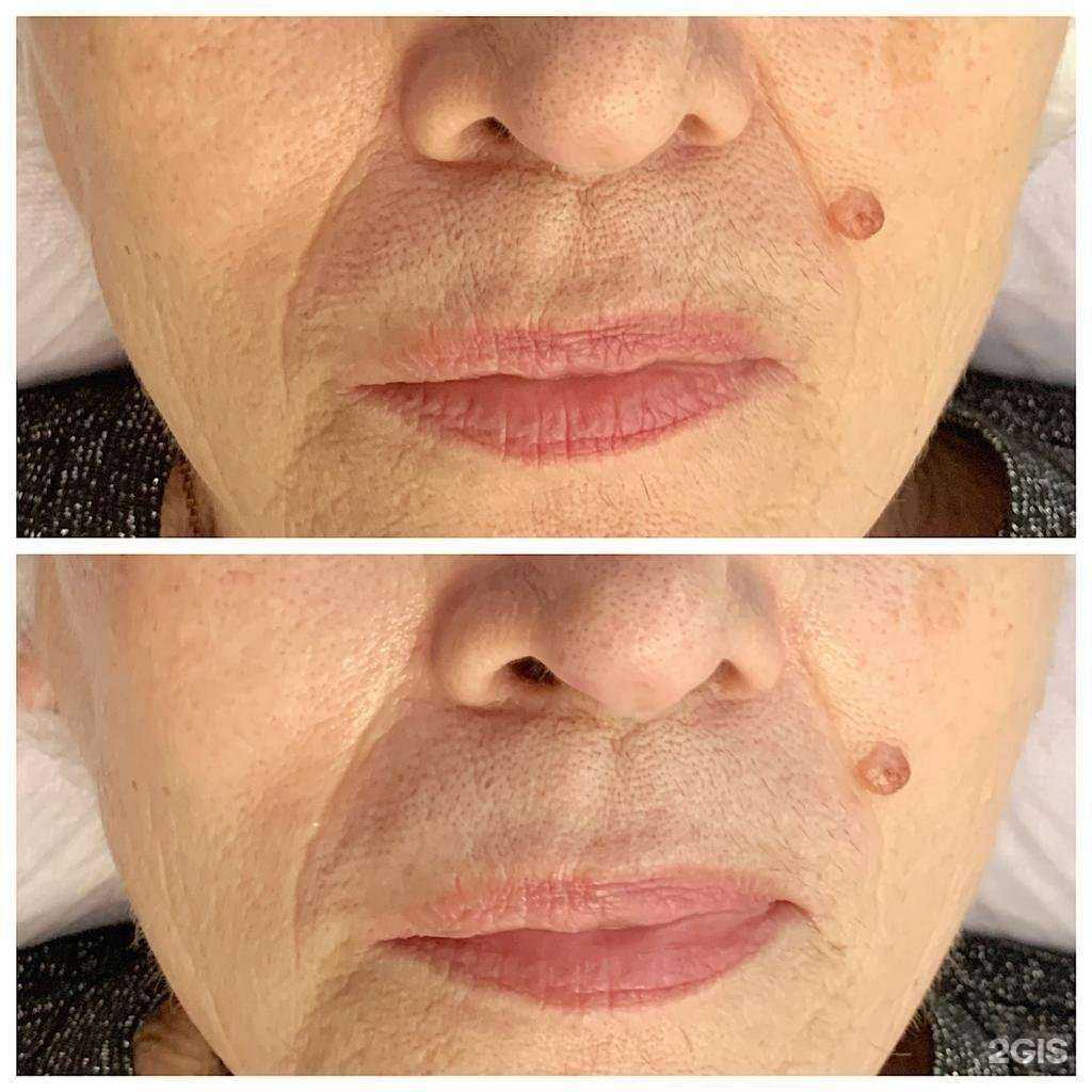 Отзывы на компанию SweetLaser в Екатеринбурге c фото