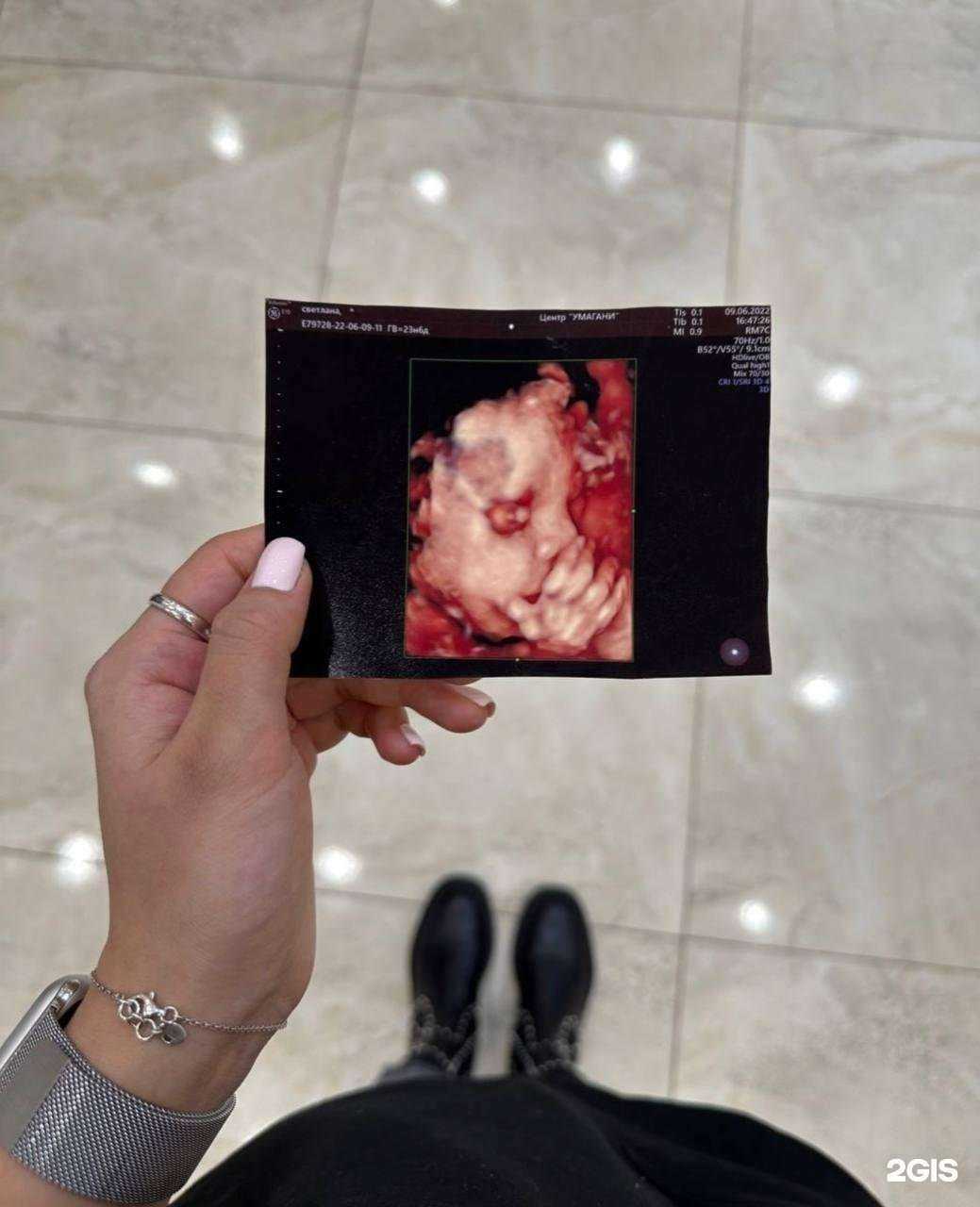 Отзывы на компанию Кабинет УЗИ-диагностики Мудуновой Н.С. в Махачкале c фото
