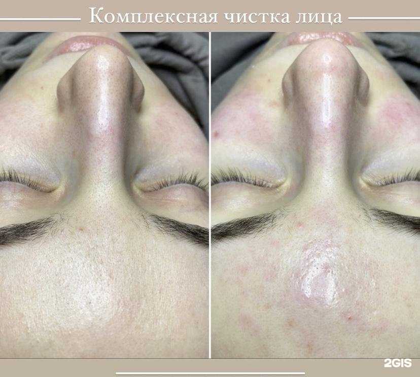 Отзывы на компанию Кабинет косметолога-эстетиста в Балакове c фото