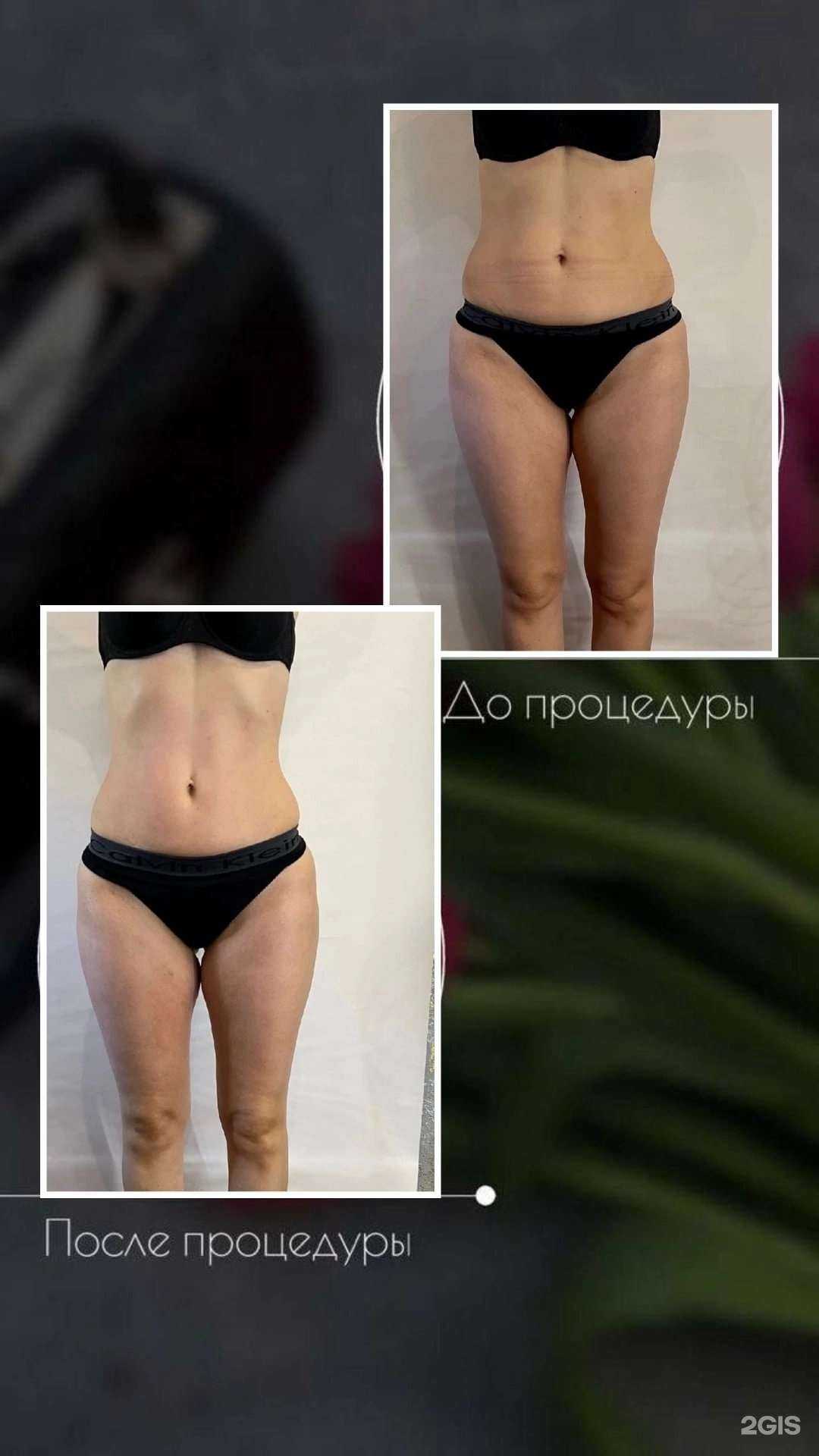 Отзывы на компанию Beauty body 89 в Новом Уренгое c фото