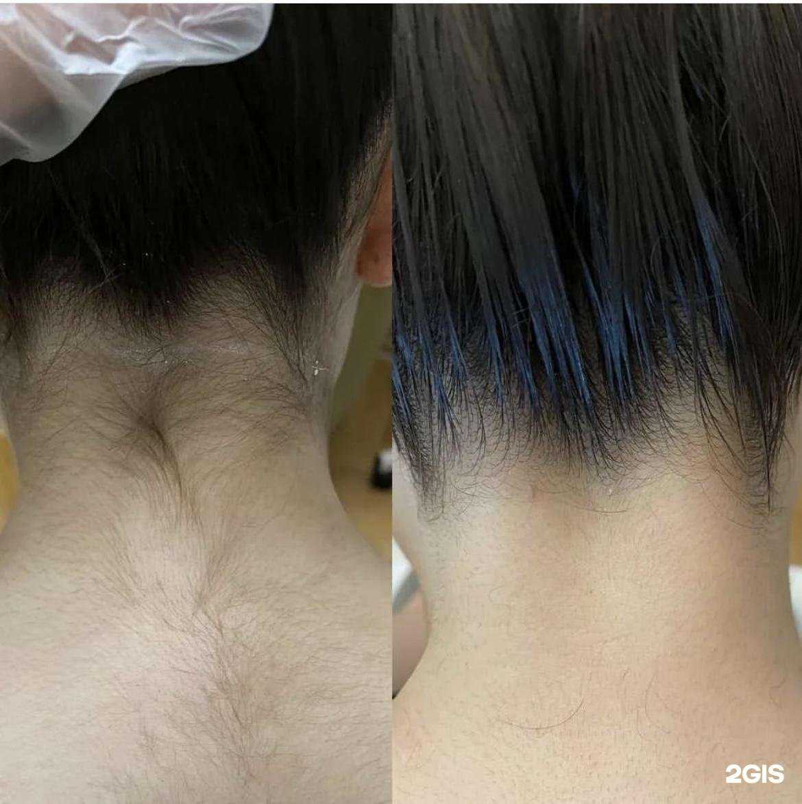 Отзывы на компанию Laser Dream в Махачкале c фото