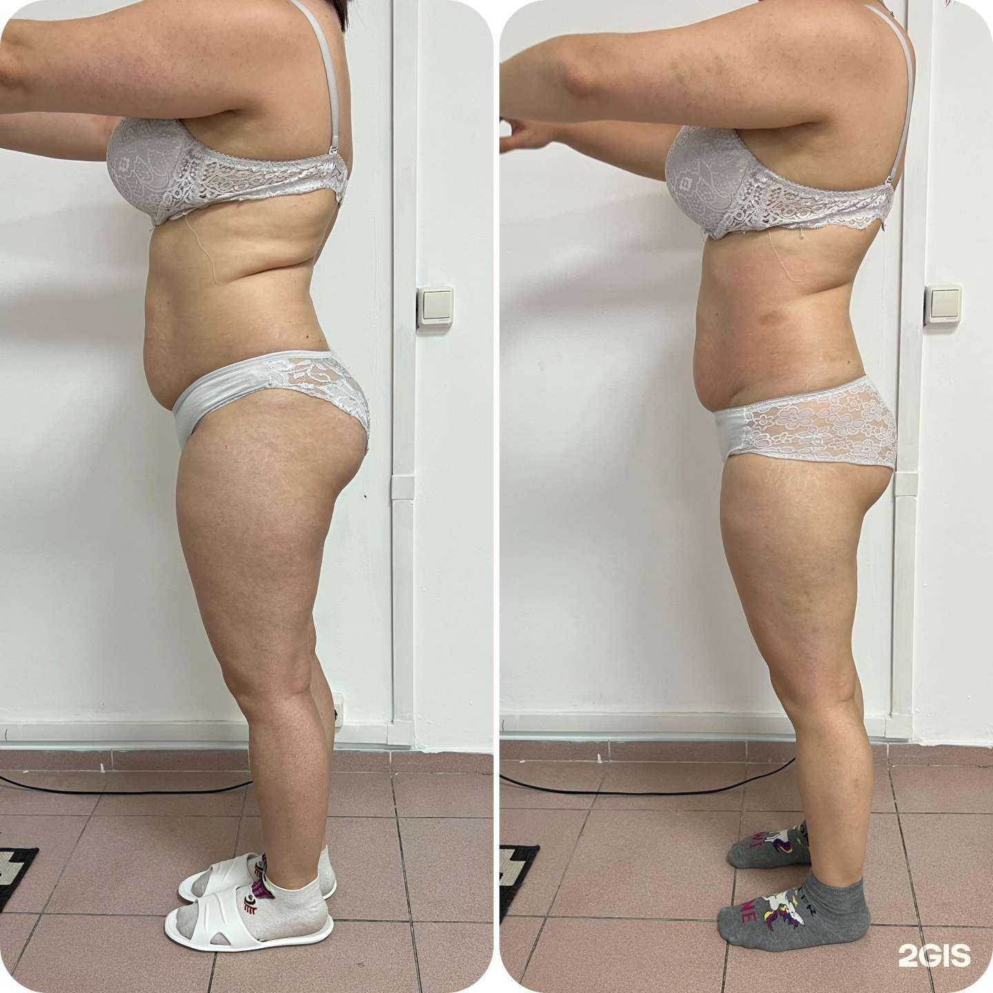 Отзывы на компанию Новый Силуэт в Иркутске c фото