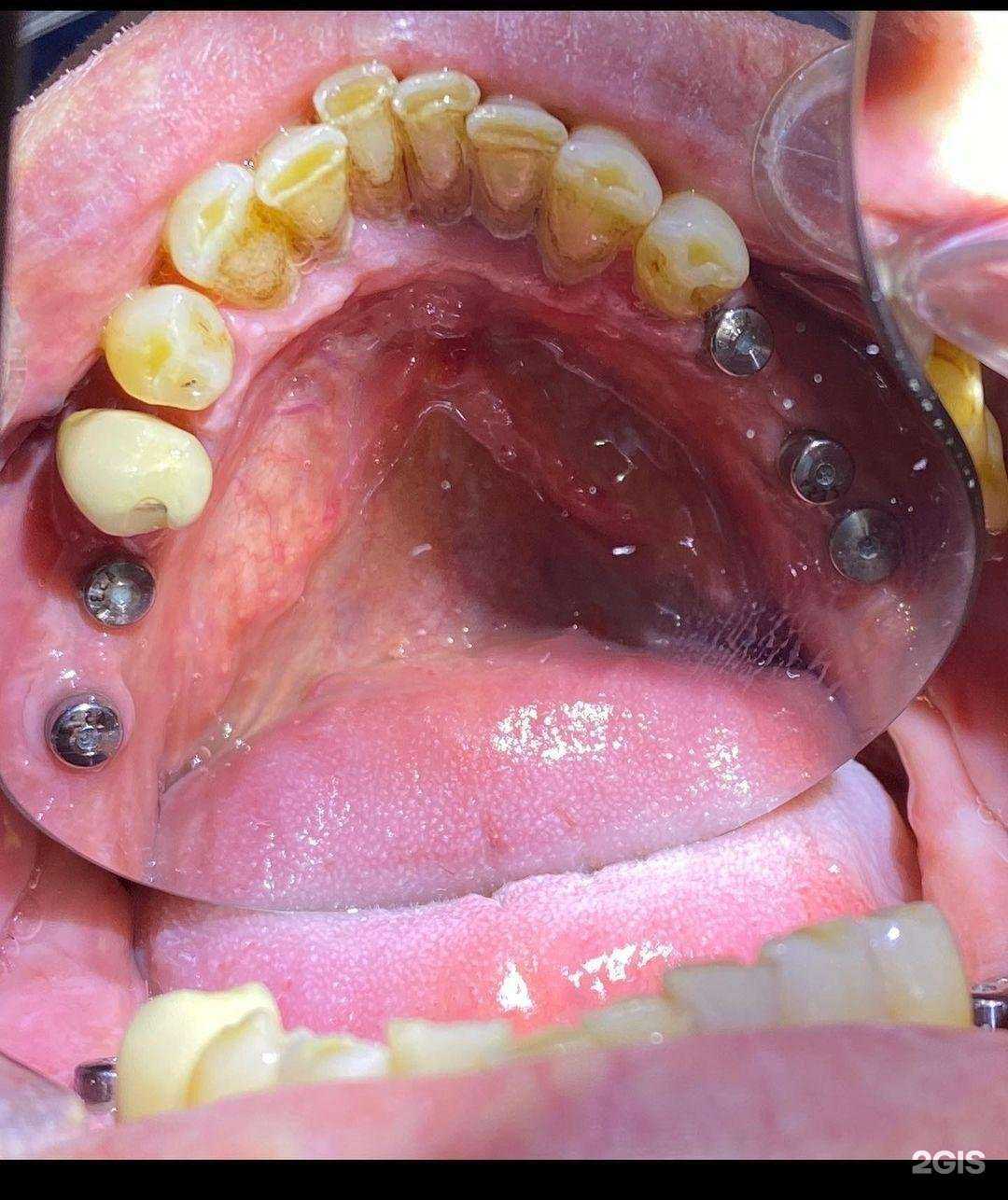 Отзывы на компанию Дентал Плюс в г. Махачкала c фото