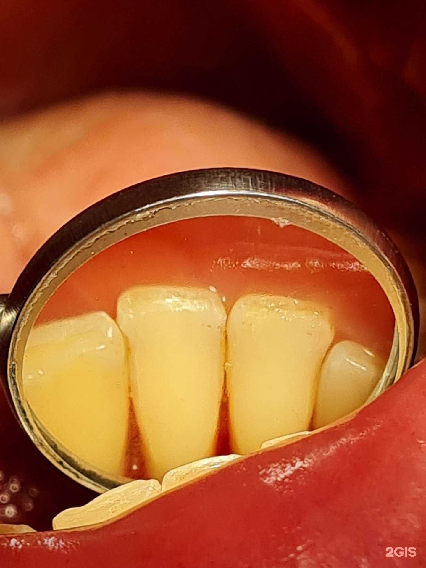 Отзывы на компанию Натадент в г. Новосибирск c фото