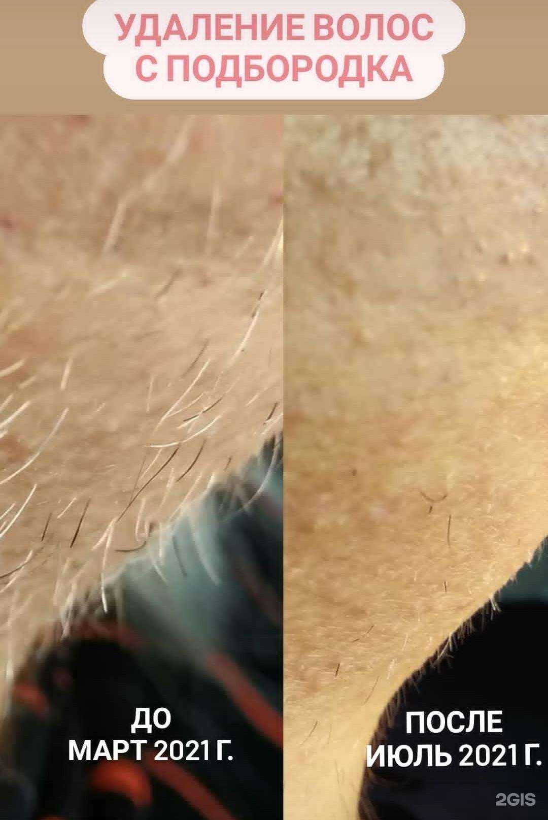 Отзывы на компанию Epili_Ni  в Екатеринбурге c фото