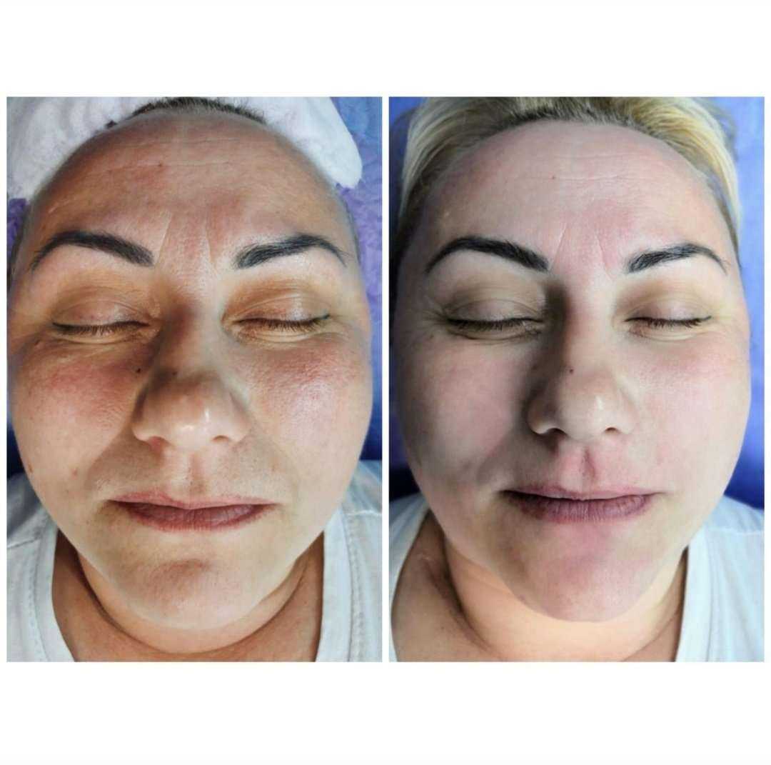 Отзывы на компанию Iris Beauty в Екатеринбурге c фото