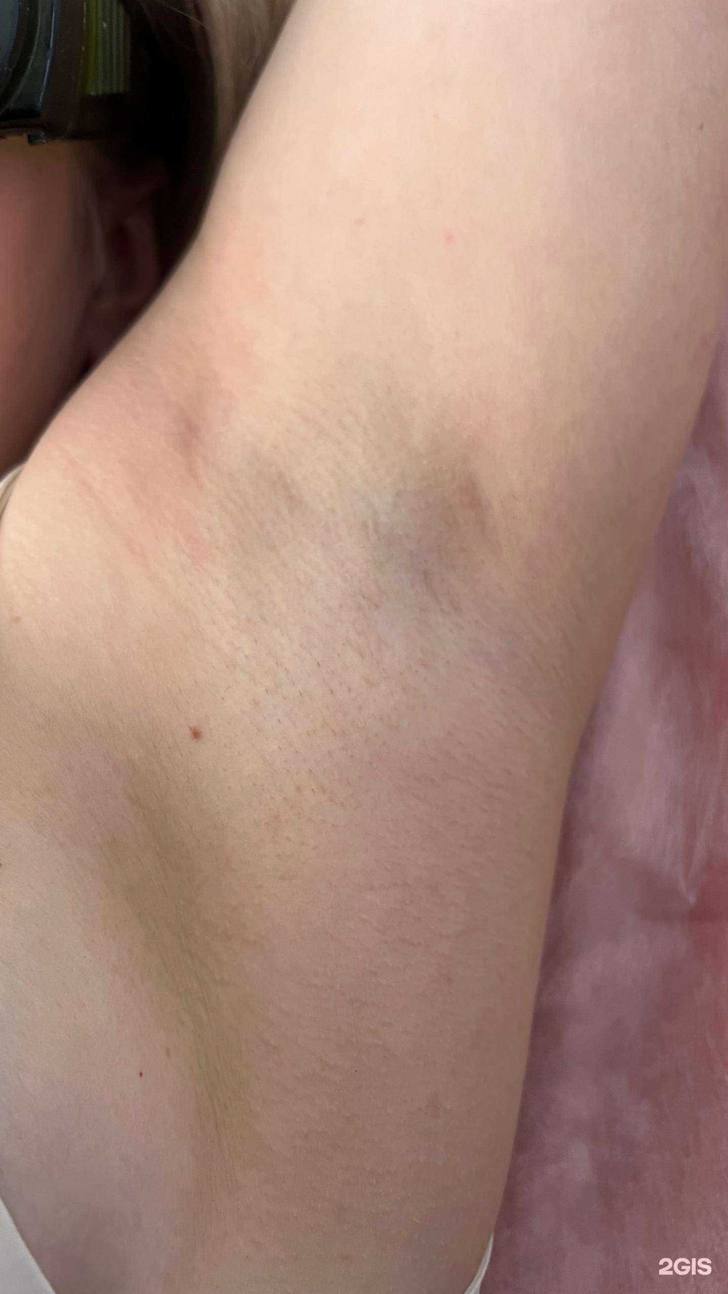 Отзывы на компанию Laser Beauty в Ангарске c фото