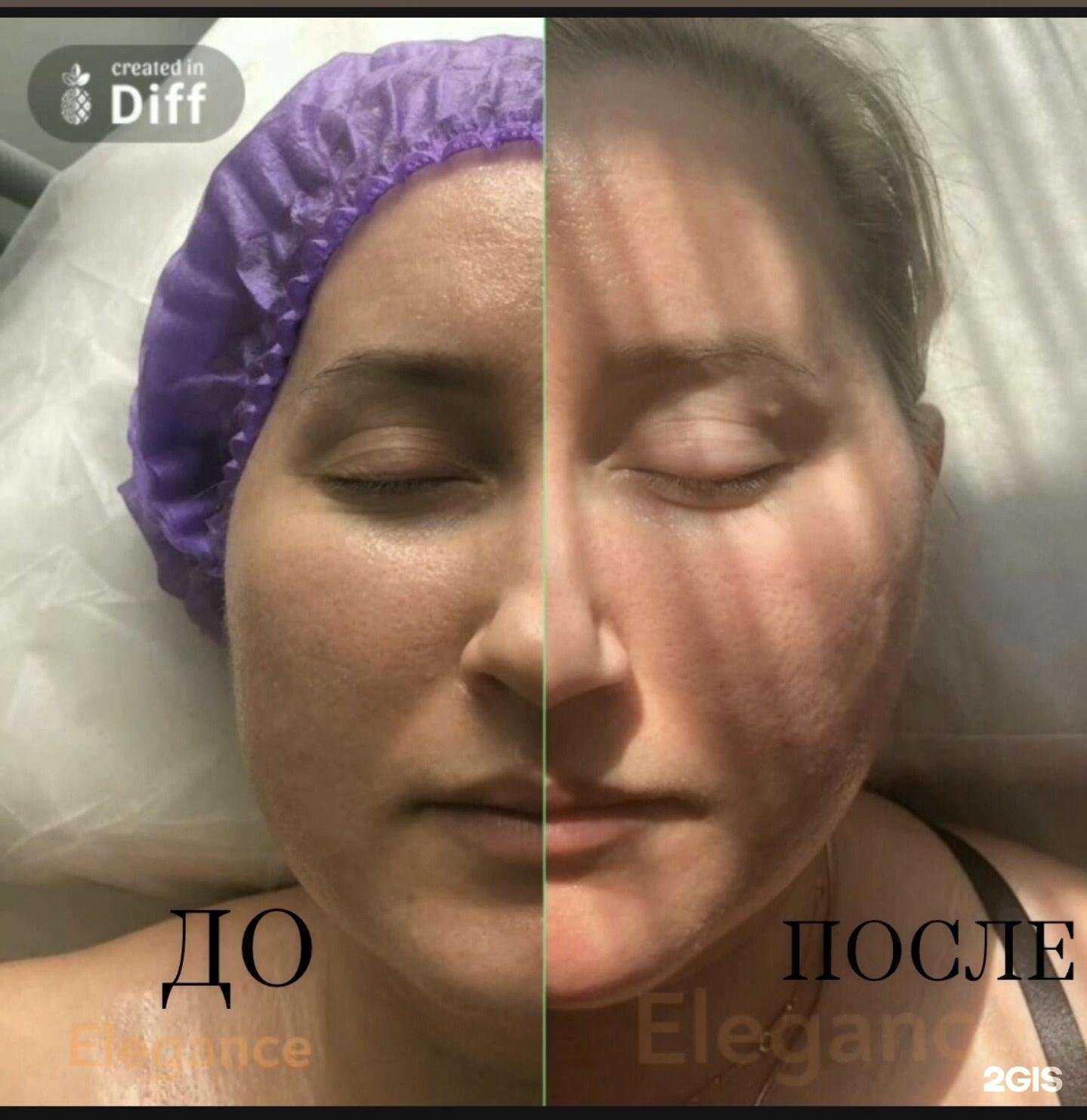 Отзывы на компанию Студия эстетики лица и тела в Северске c фото