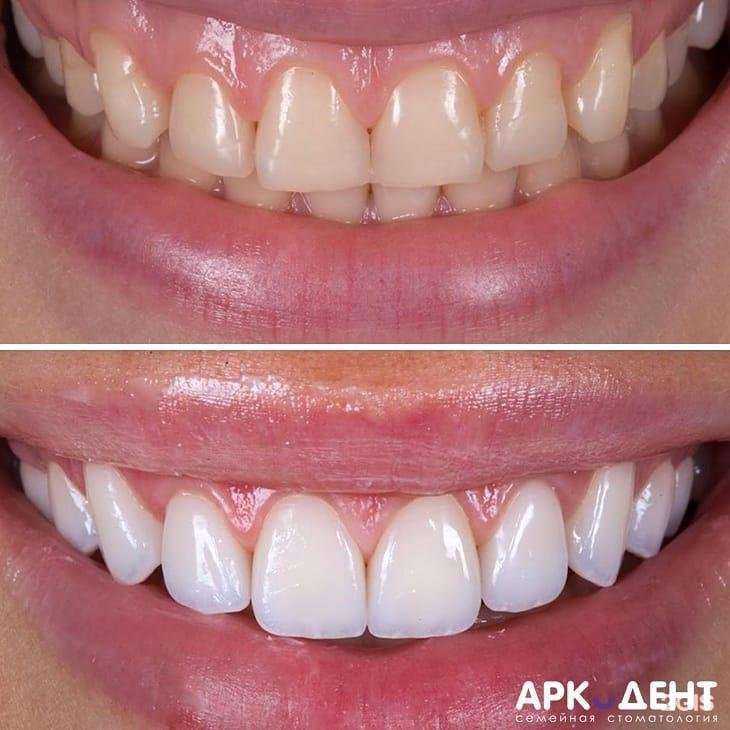 Отзывы на компанию Arcodent в Краснодаре c фото