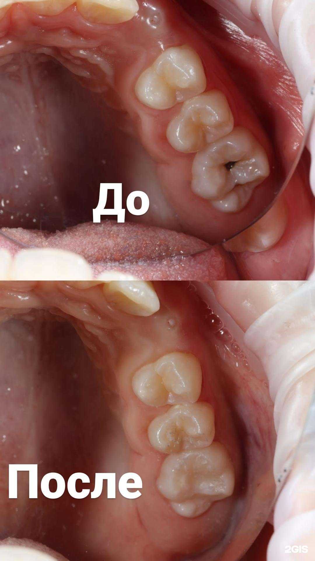 Отзывы на компанию UpDent в г. Махачкала c фото