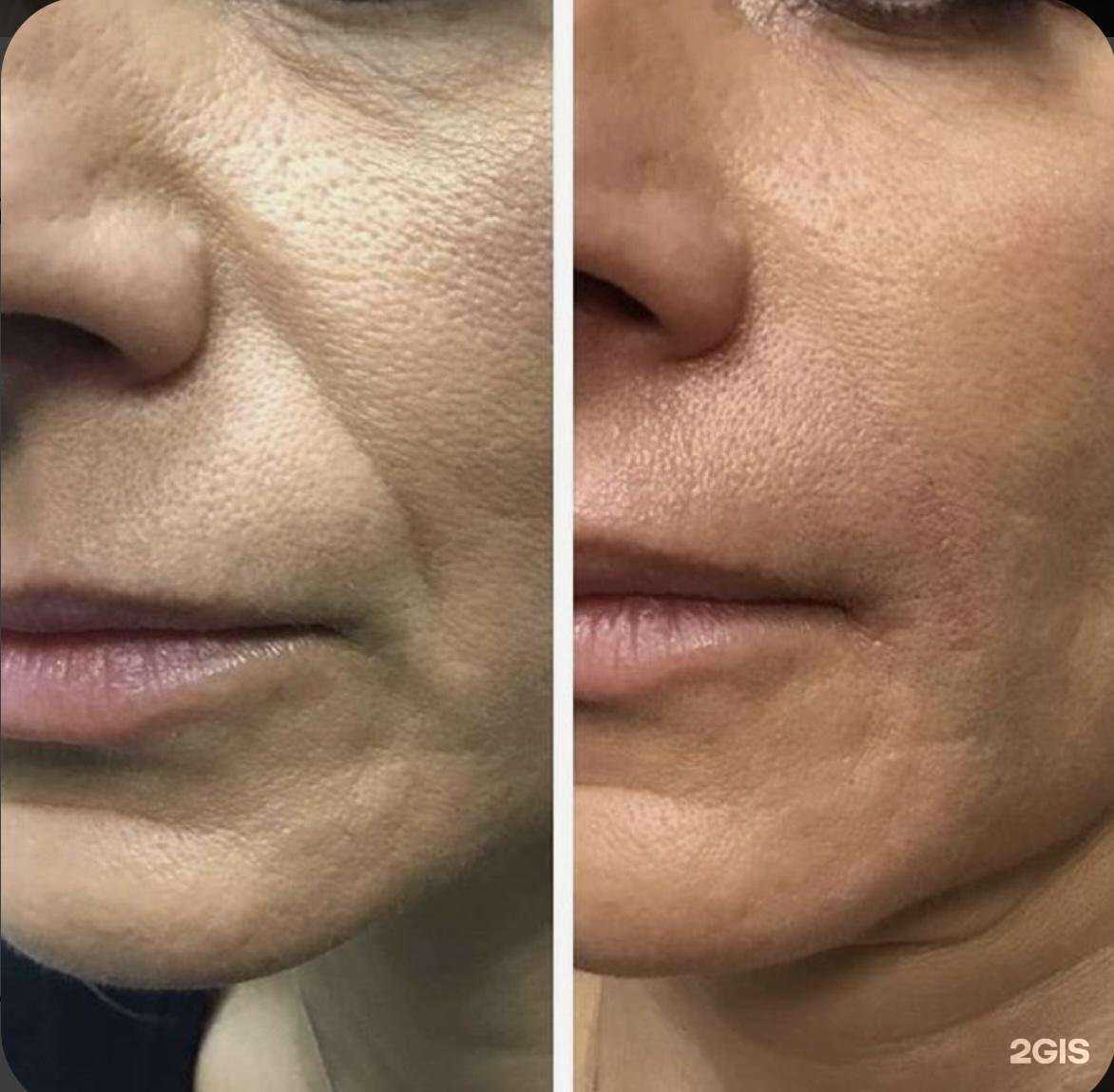 Отзывы на компанию Студия косметолога Хавы Мальсаговой в г. Каспийск c фото