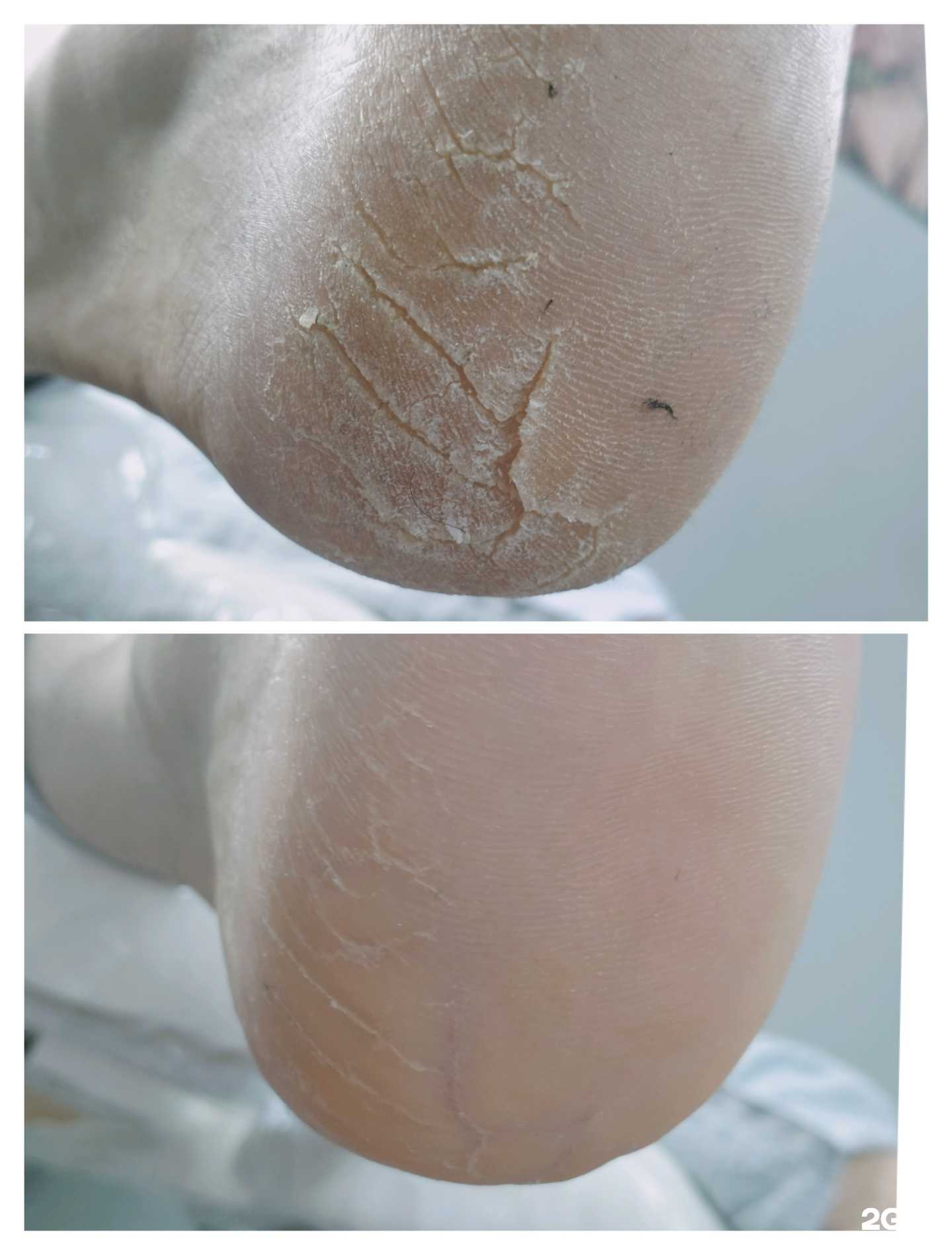 Отзывы на компанию Студия медицинского педикюра и подологии в Краснодаре c фото