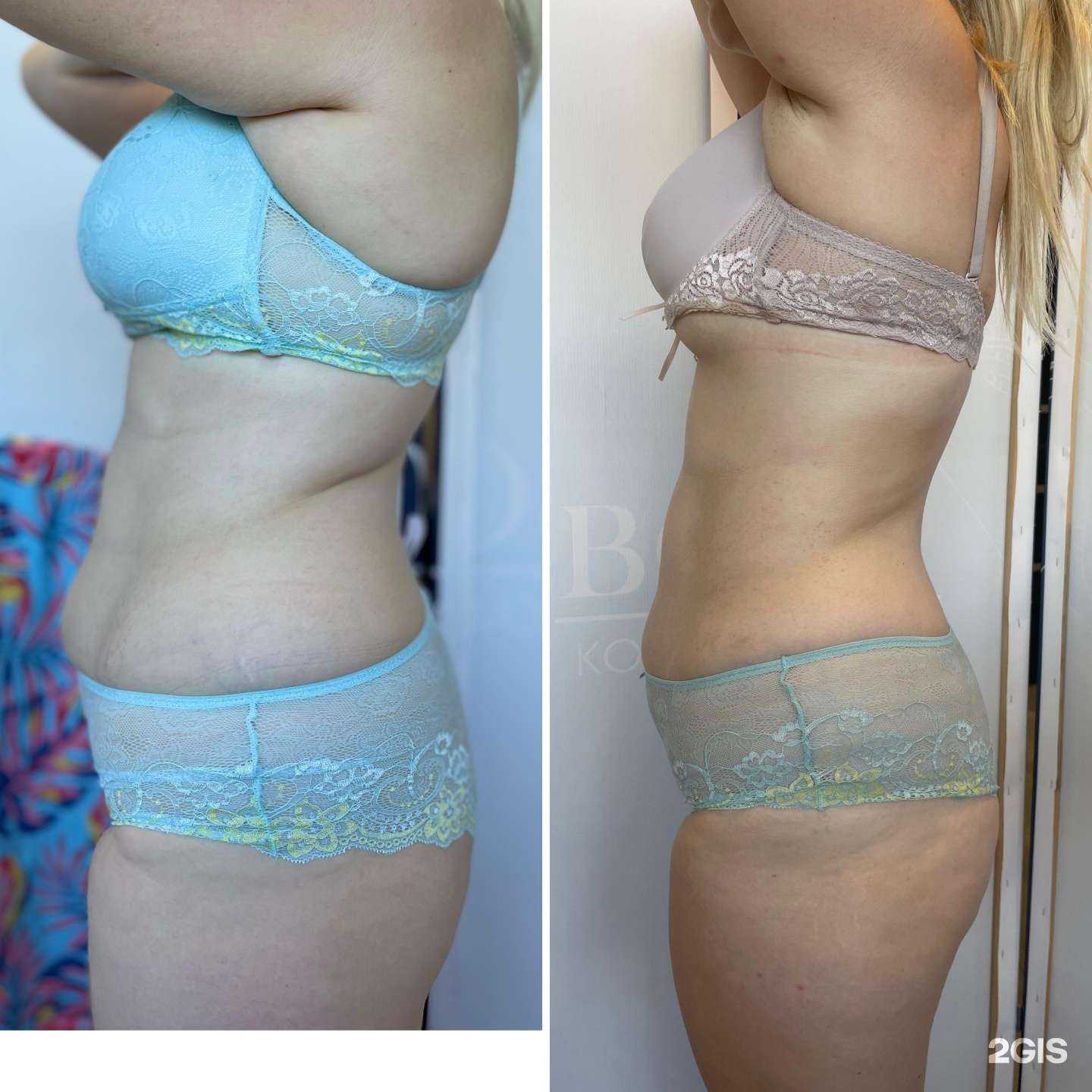 Отзывы на компанию Body Perfect в Новороссийске c фото