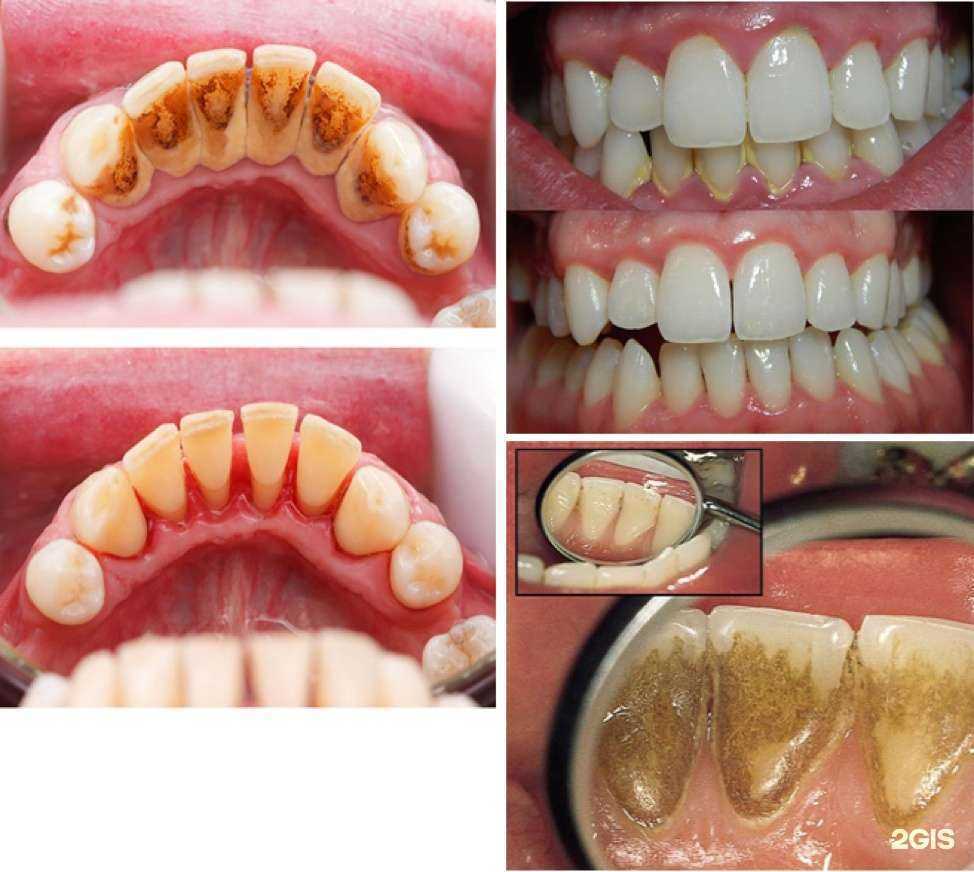 Отзывы на компанию Aрка-стом в Краснодаре c фото